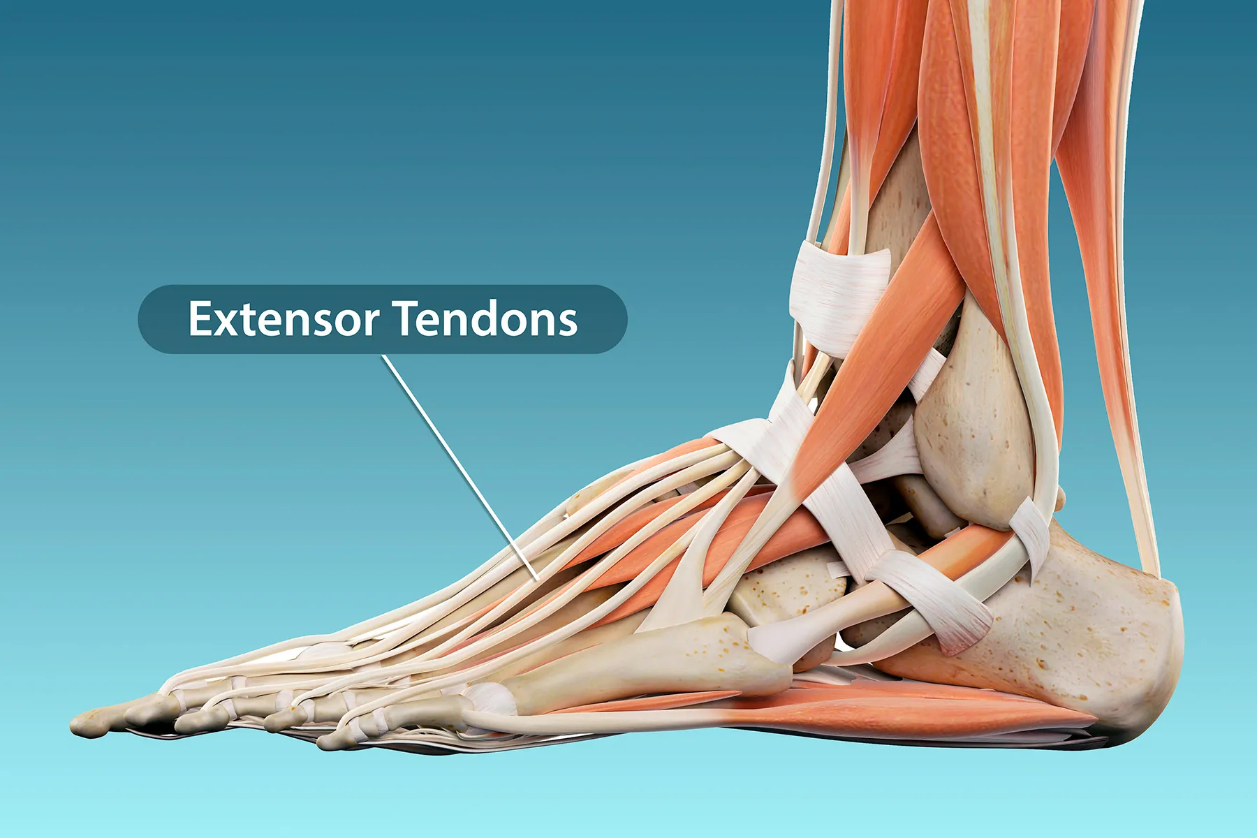 Foot Tendonitis Treatment