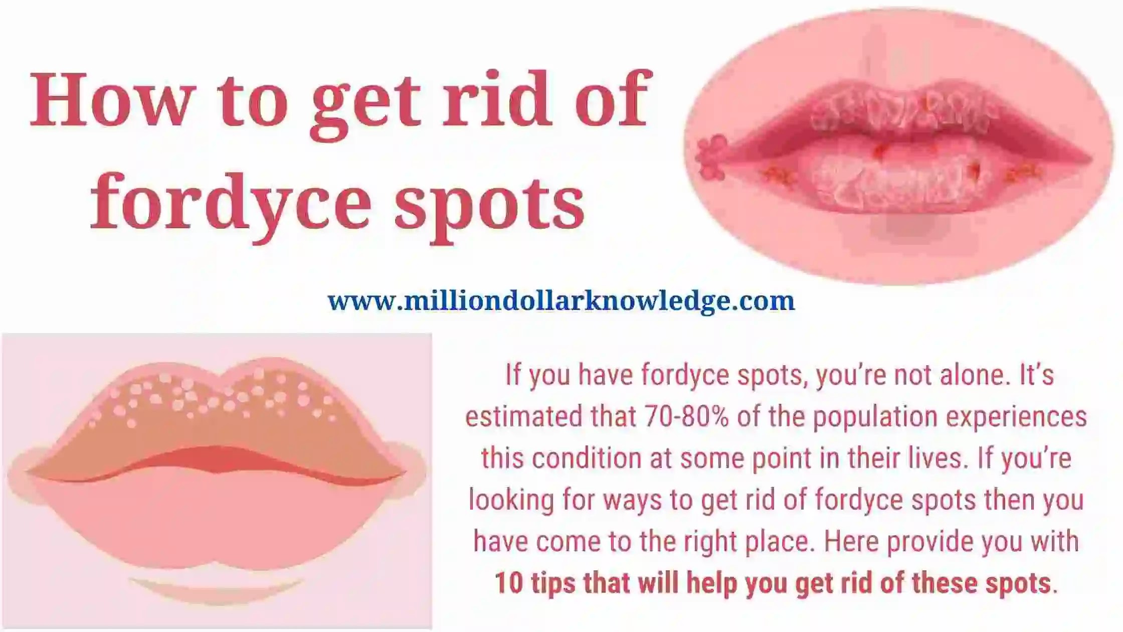 Fordyce Spots Vagina