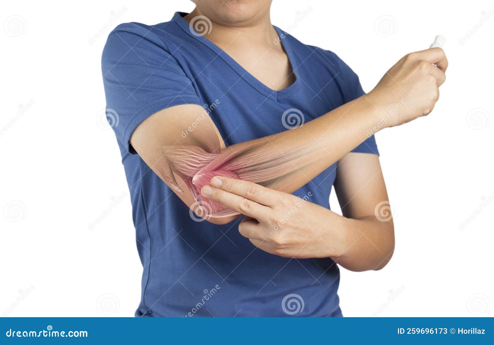 Forearm Muscle Pain