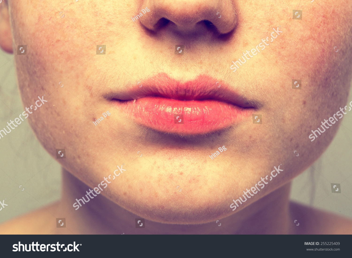 Freckles On The Lips
