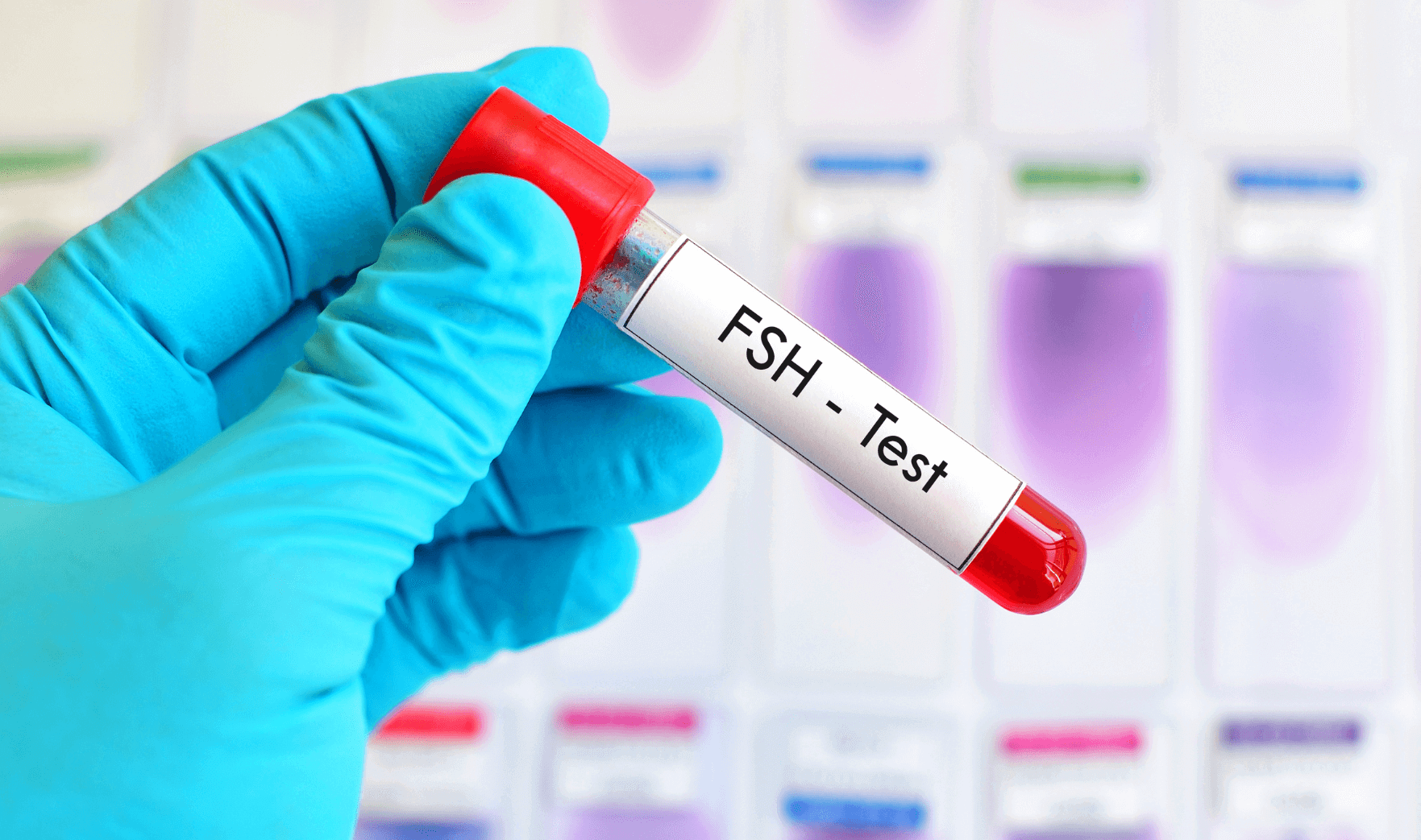 Fsh Blood Test