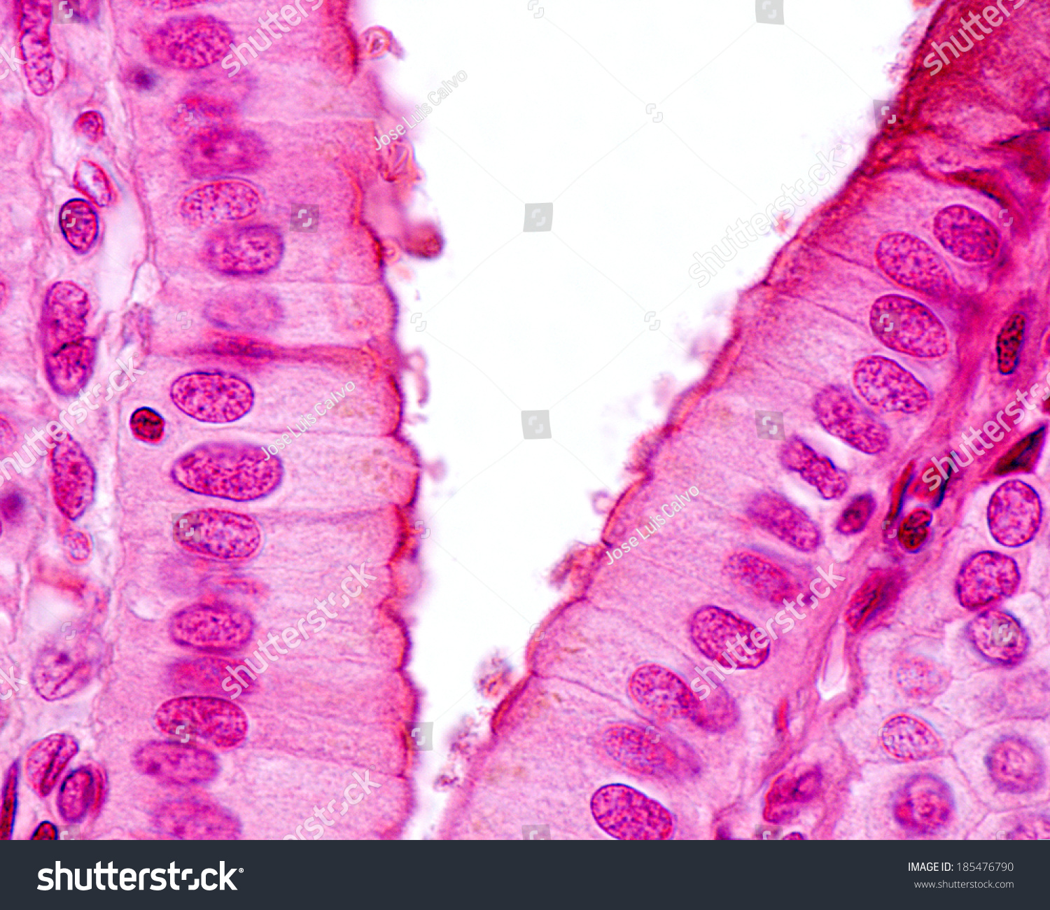 Function Of The Columnar Epithelium