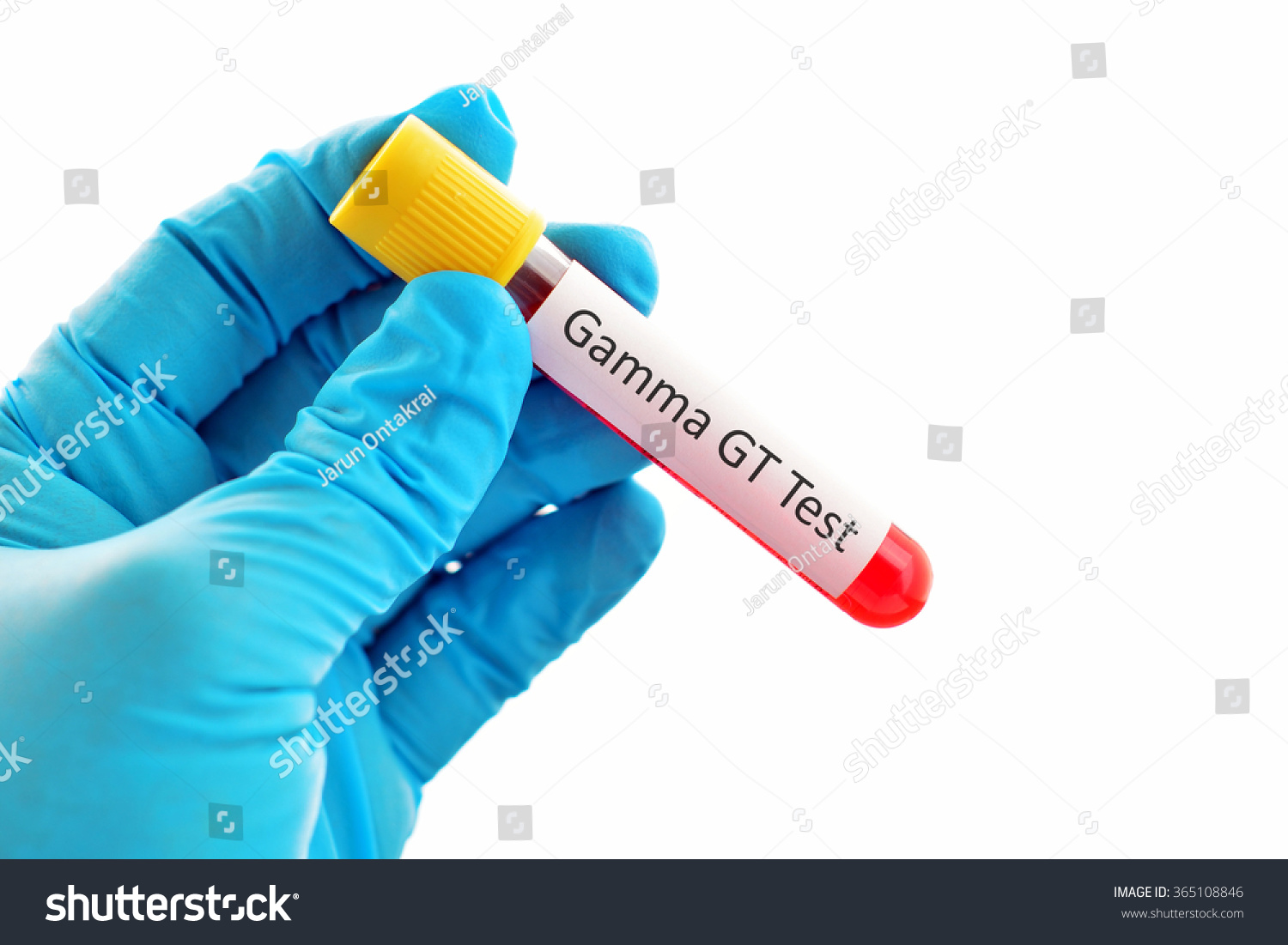 Gamma Gt Blood Test