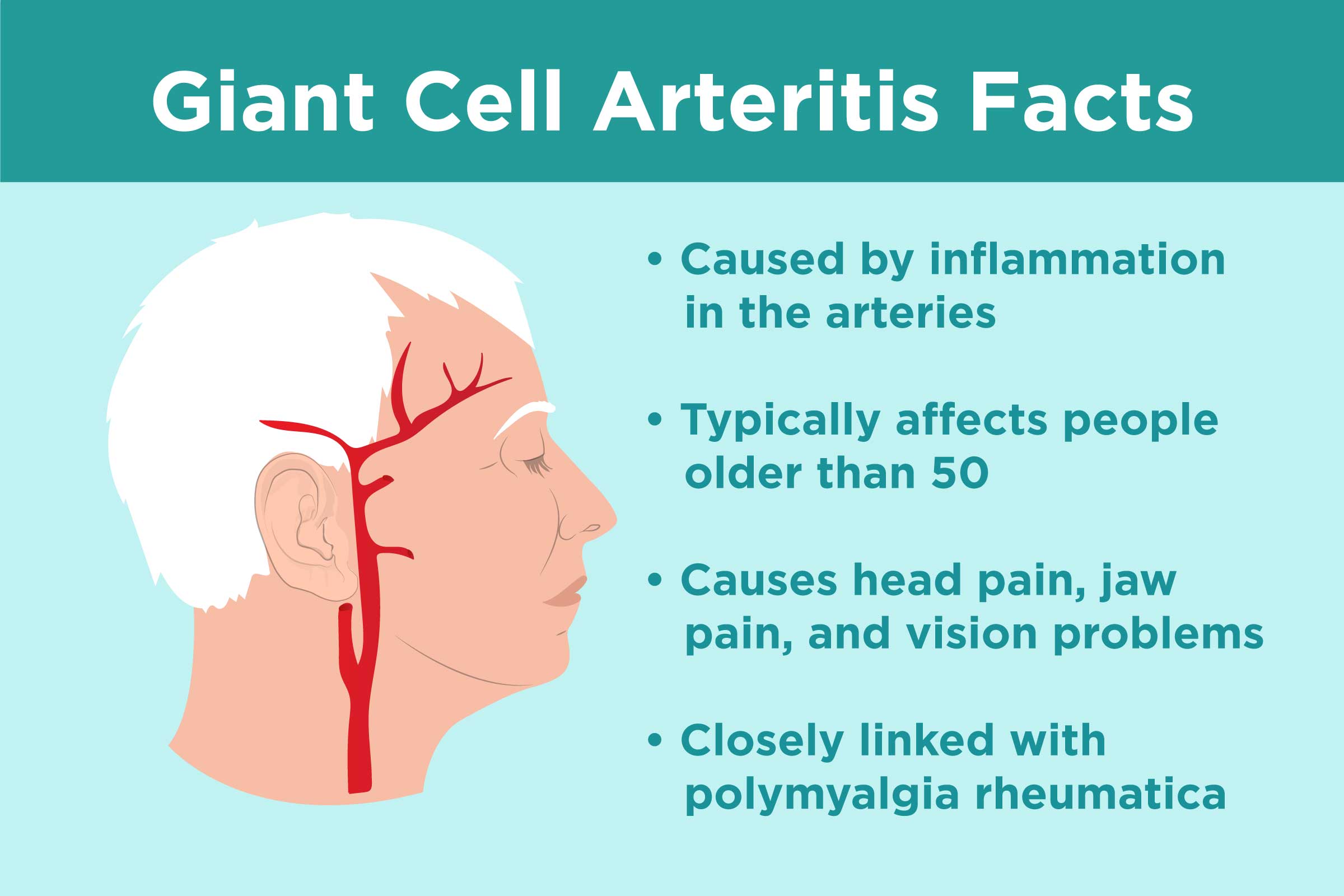 Giant Arteritis Treatment