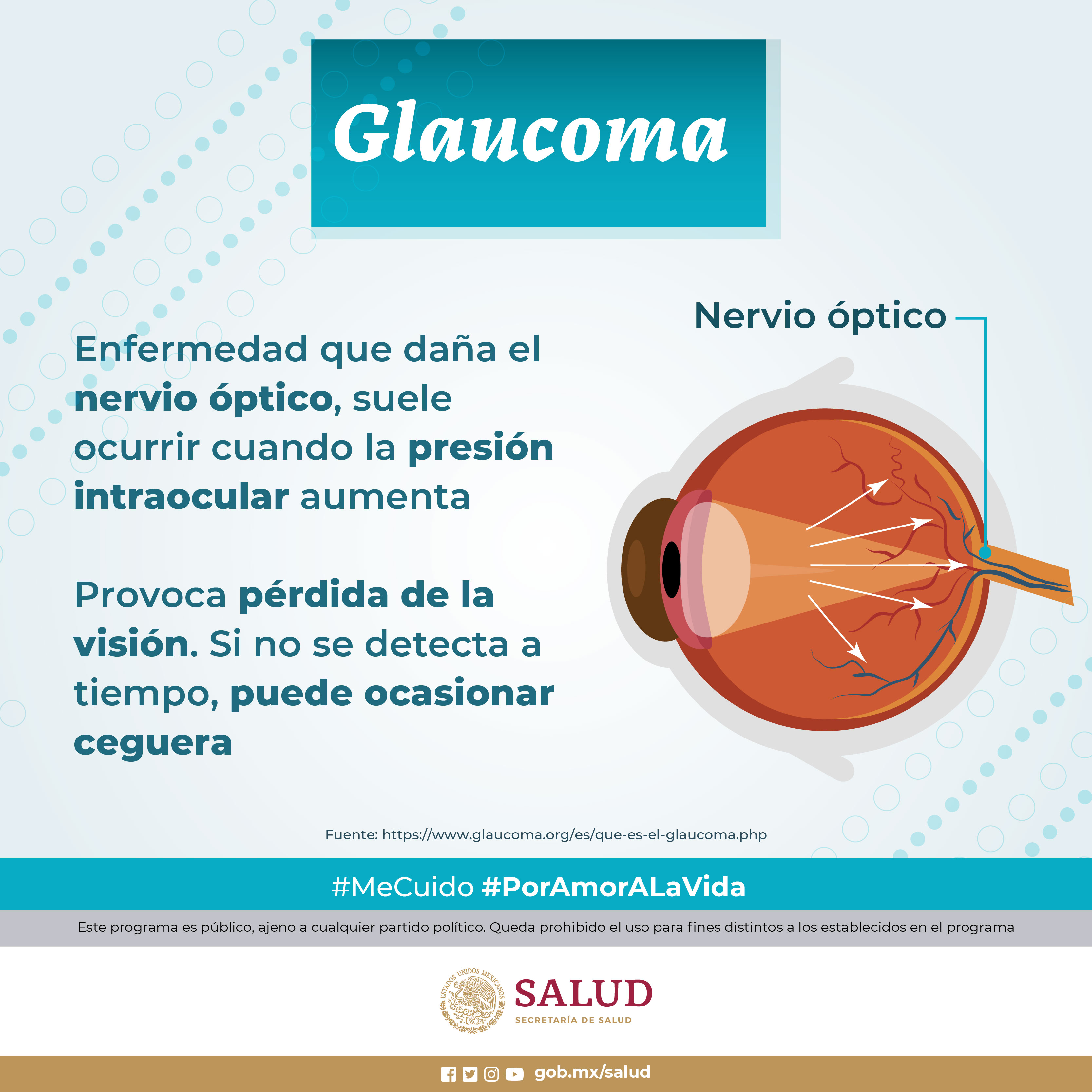 Glaucoma Que Es