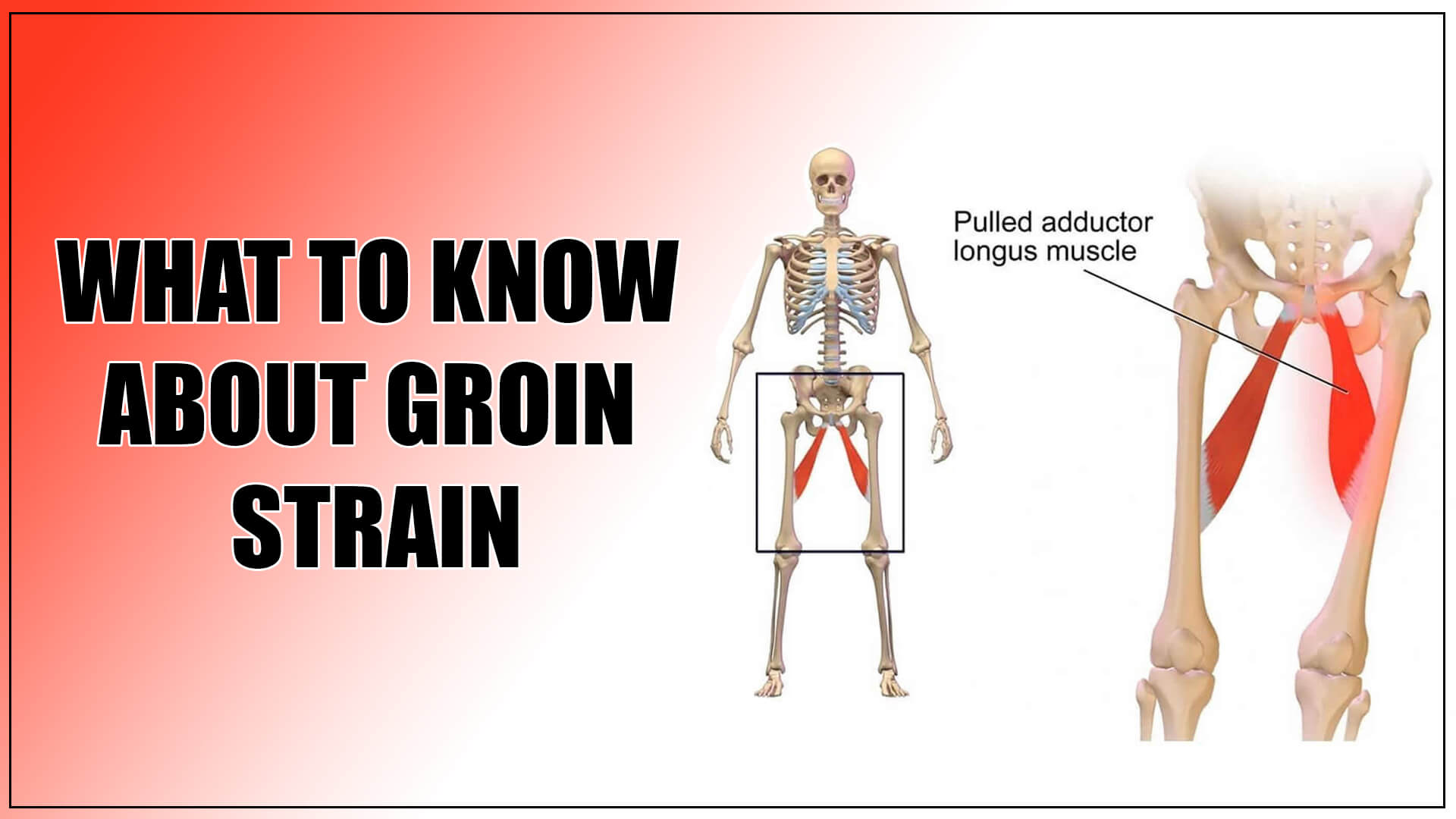 Groin Pull Recovery