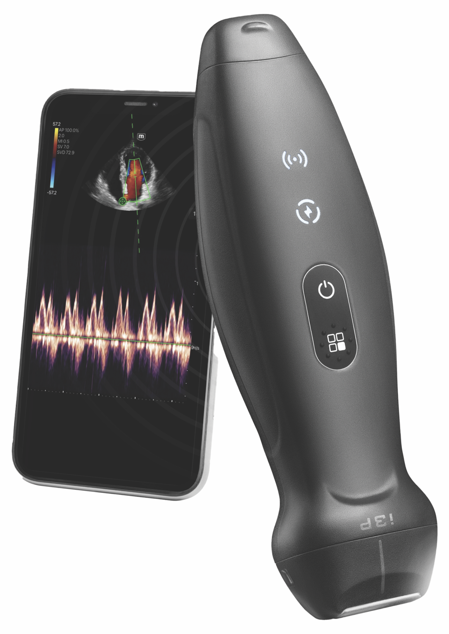 Handheld Ultrasound