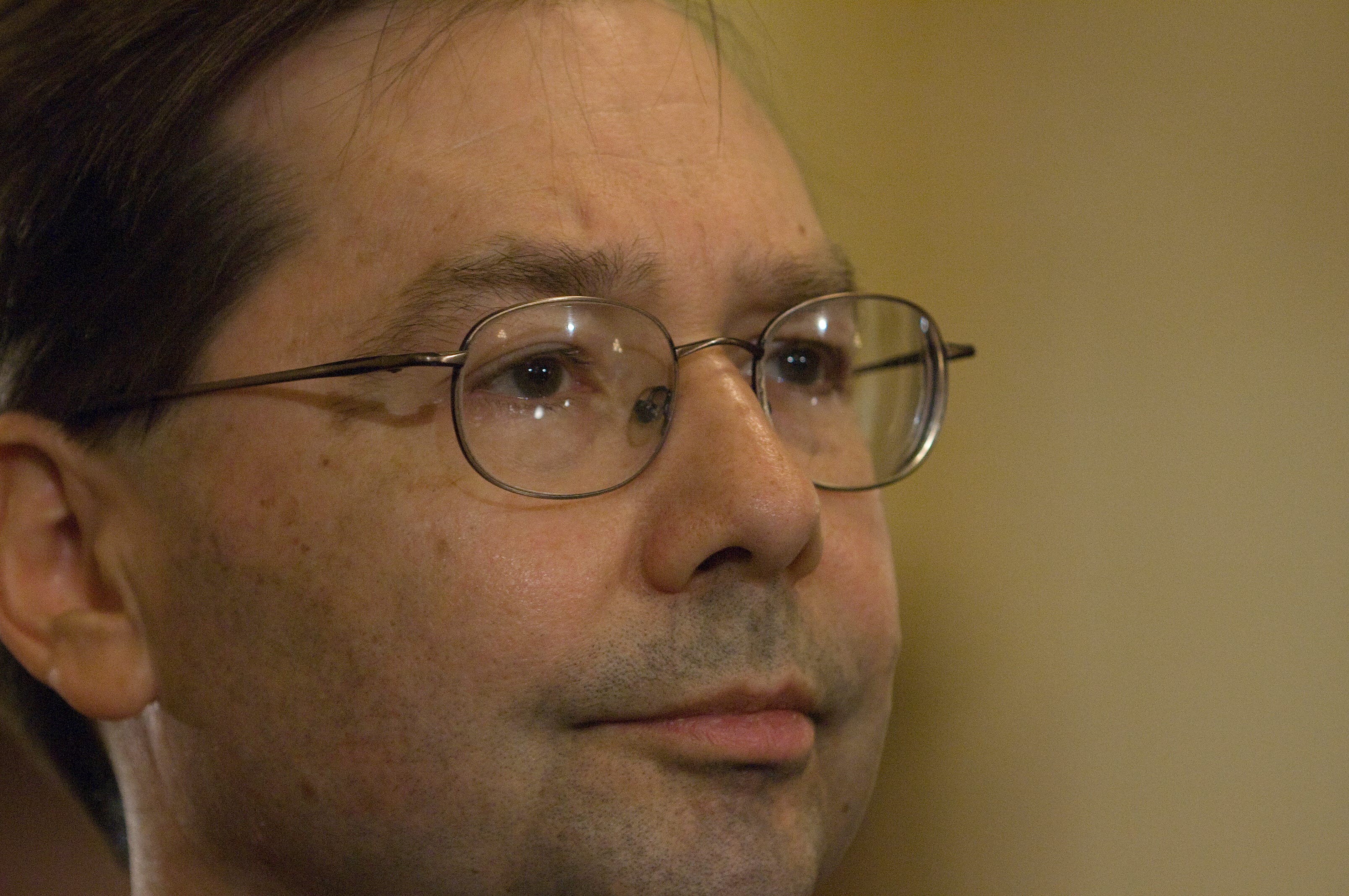 Hans Von Spakovsky Face Surgery Video