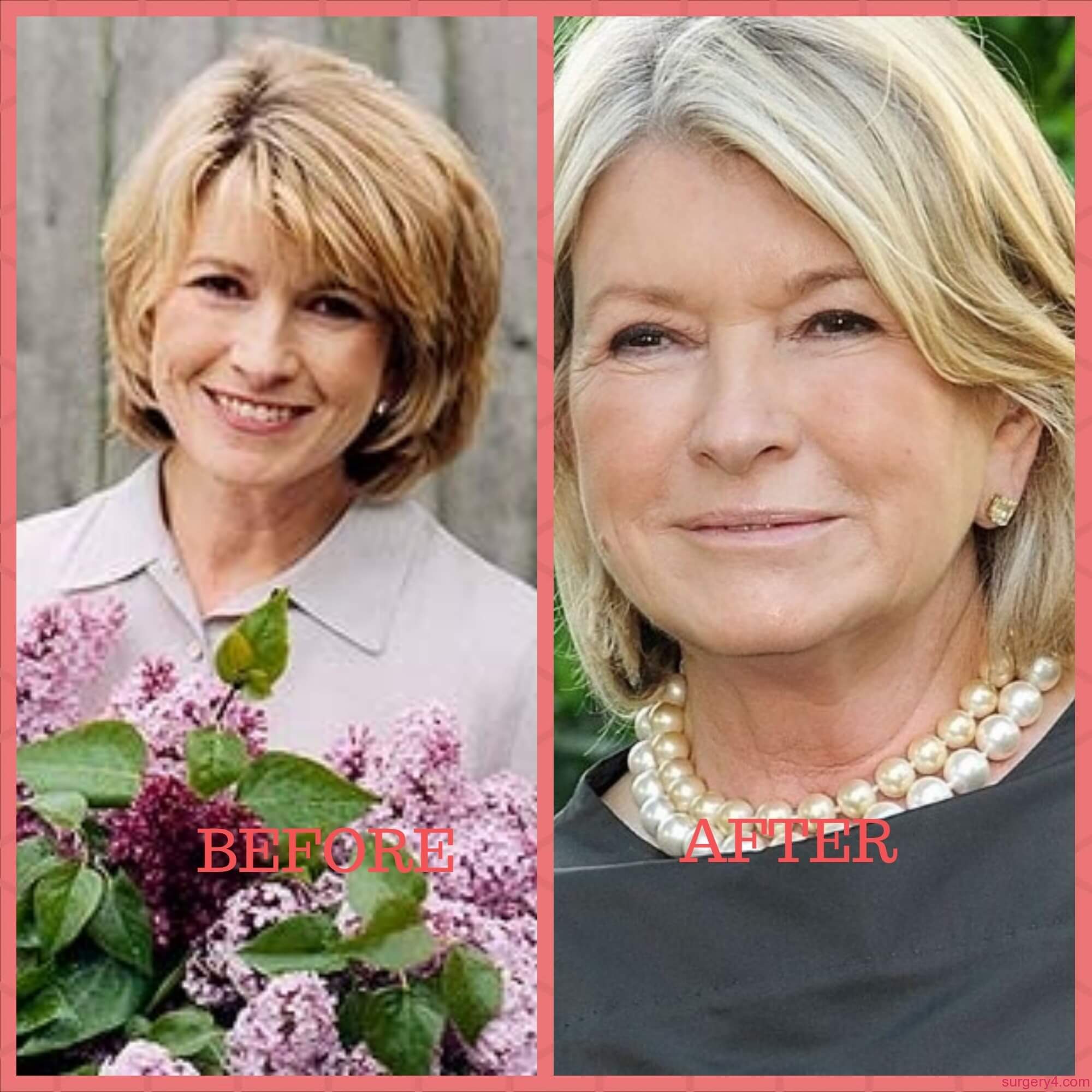 Has Martha Stewart Had Face Surgery