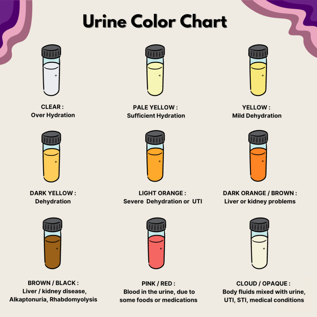 Hazy Urine In Pregnancy