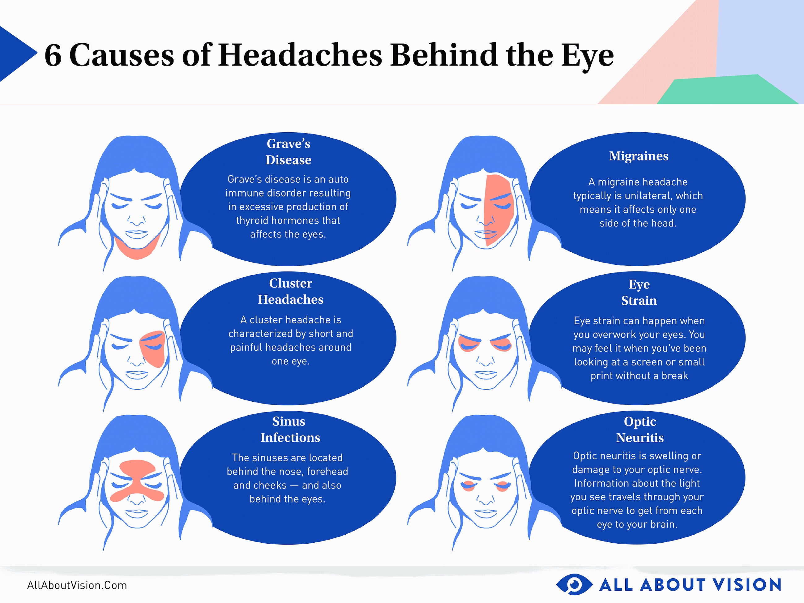 Headache Sore Behind Eyes
