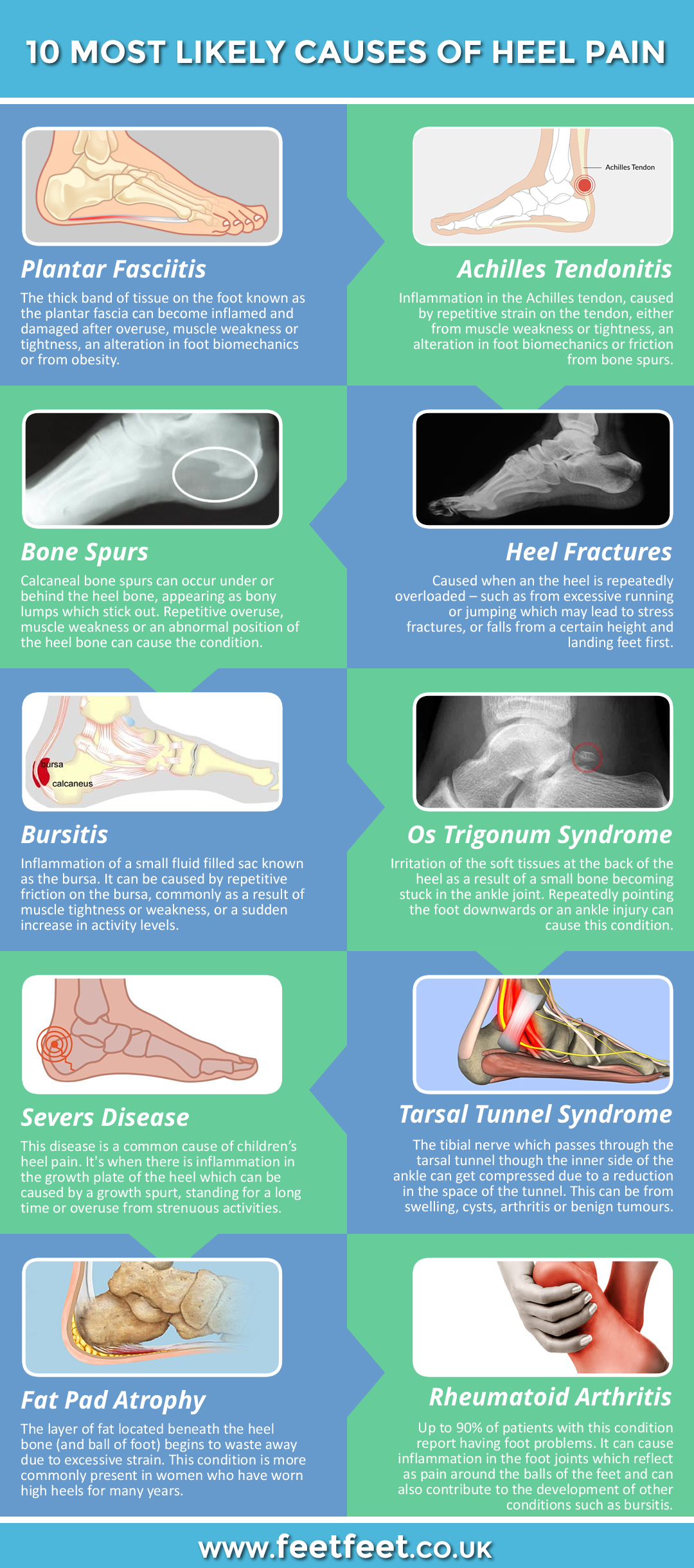 Heel Hurting Causes