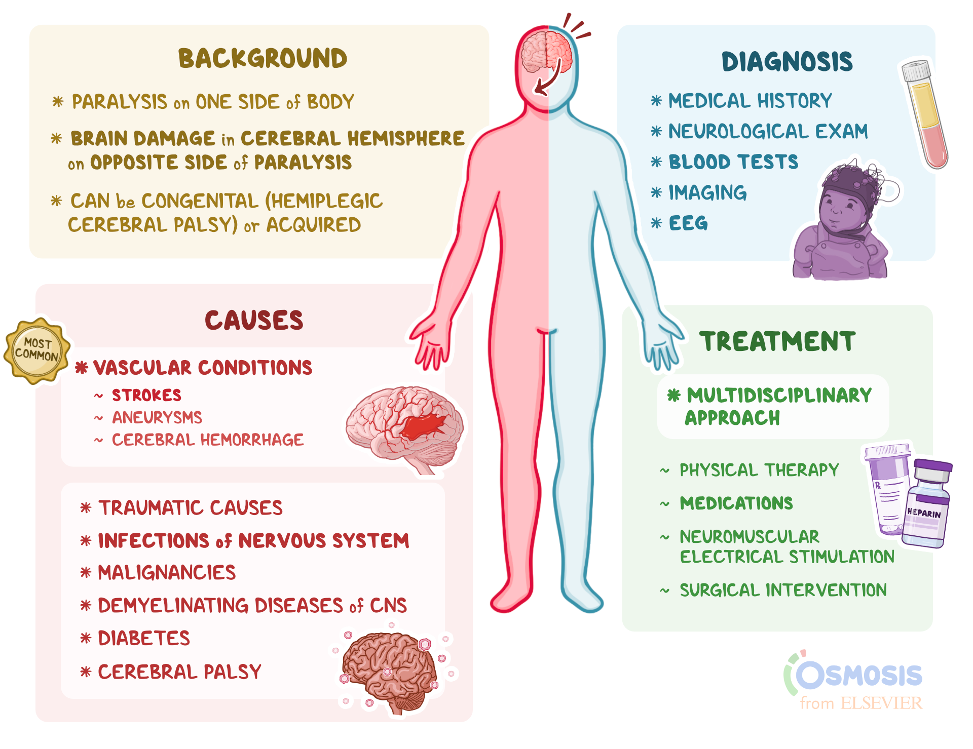 Hemiplegia Hemiparesis Definition
