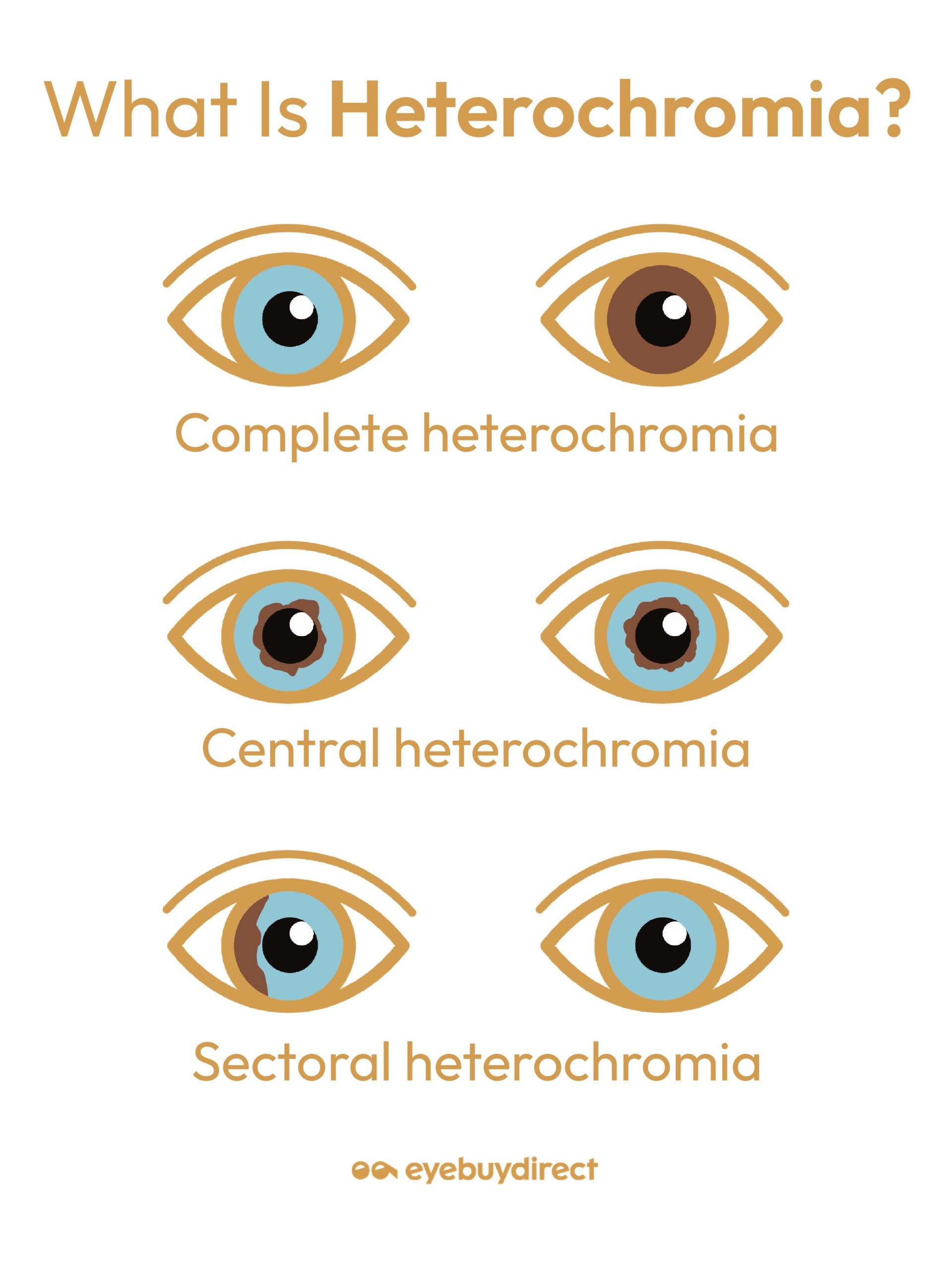 Heterochromia Does It Affect Vision