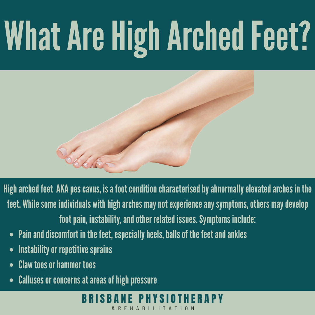 High Arched Feet