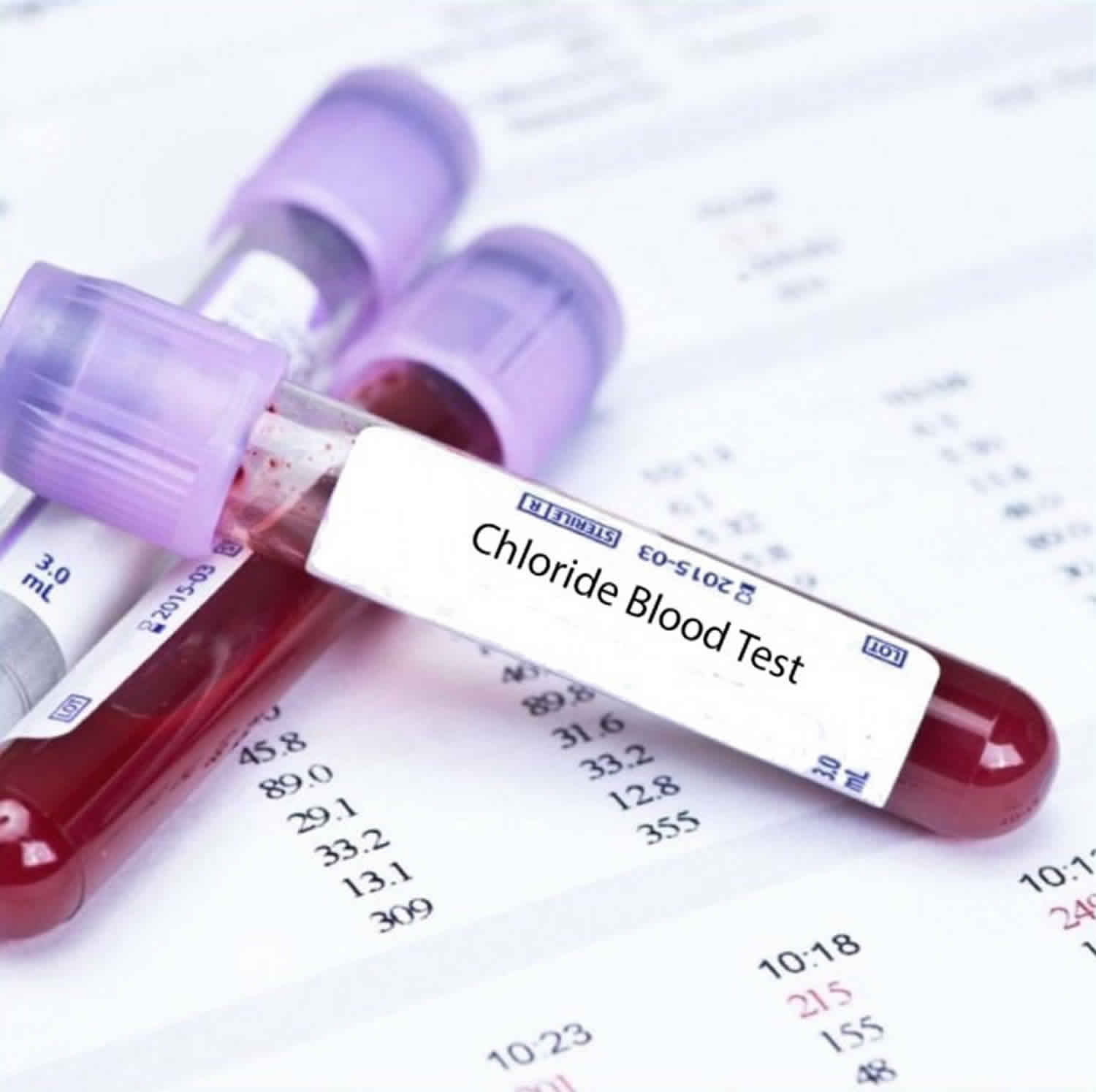 High Chloride Blood Test
