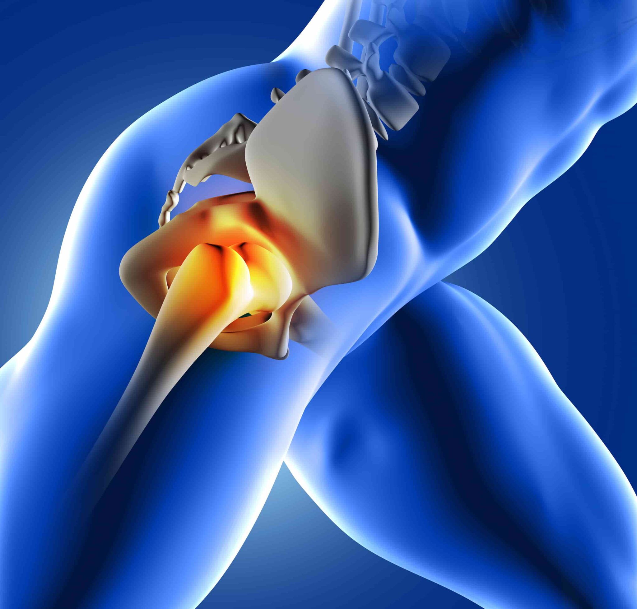 Hip Impingement Symptoms