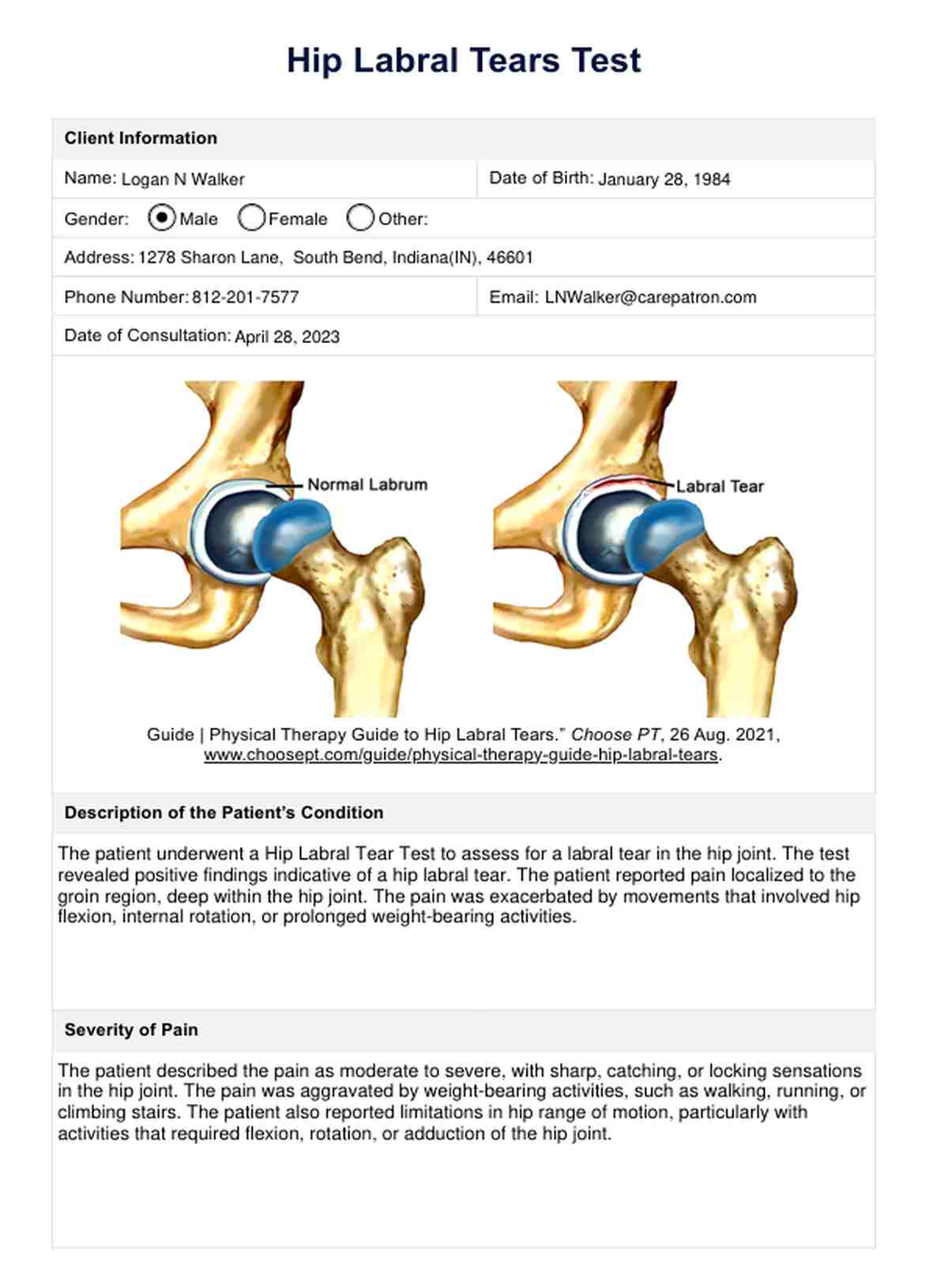 Hip Labral Tear Test