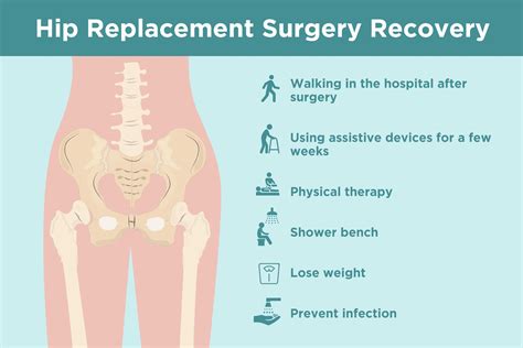 Hip Replacement Recovery Time