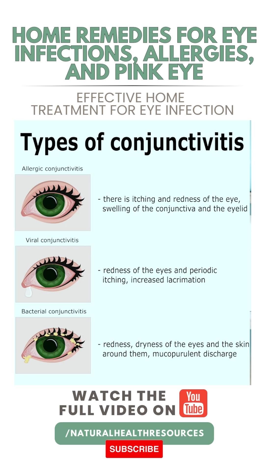 Home Remedies For Pink Eye