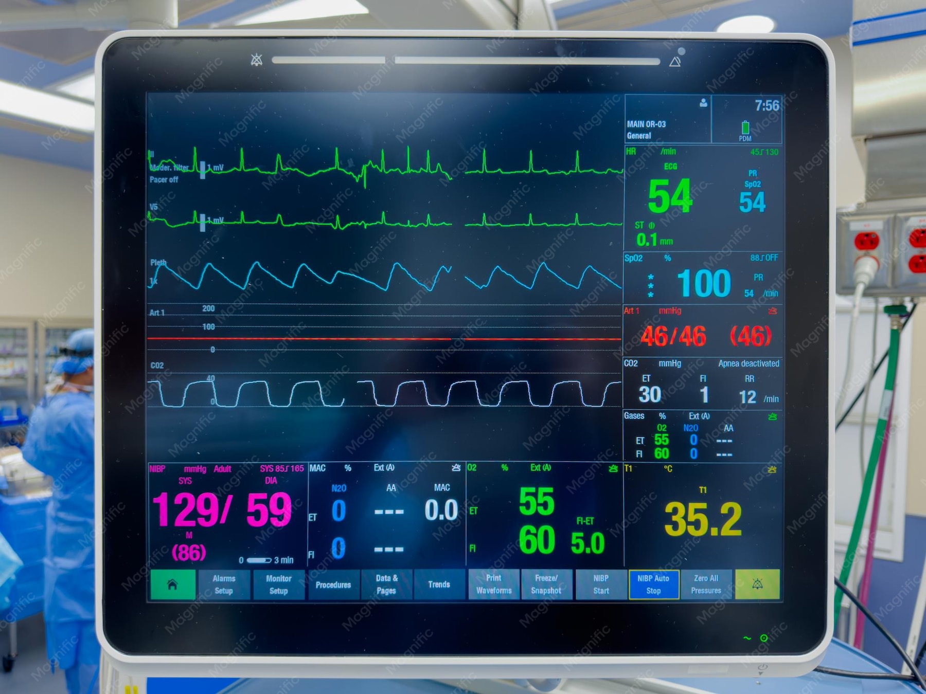 Hospital Monitor