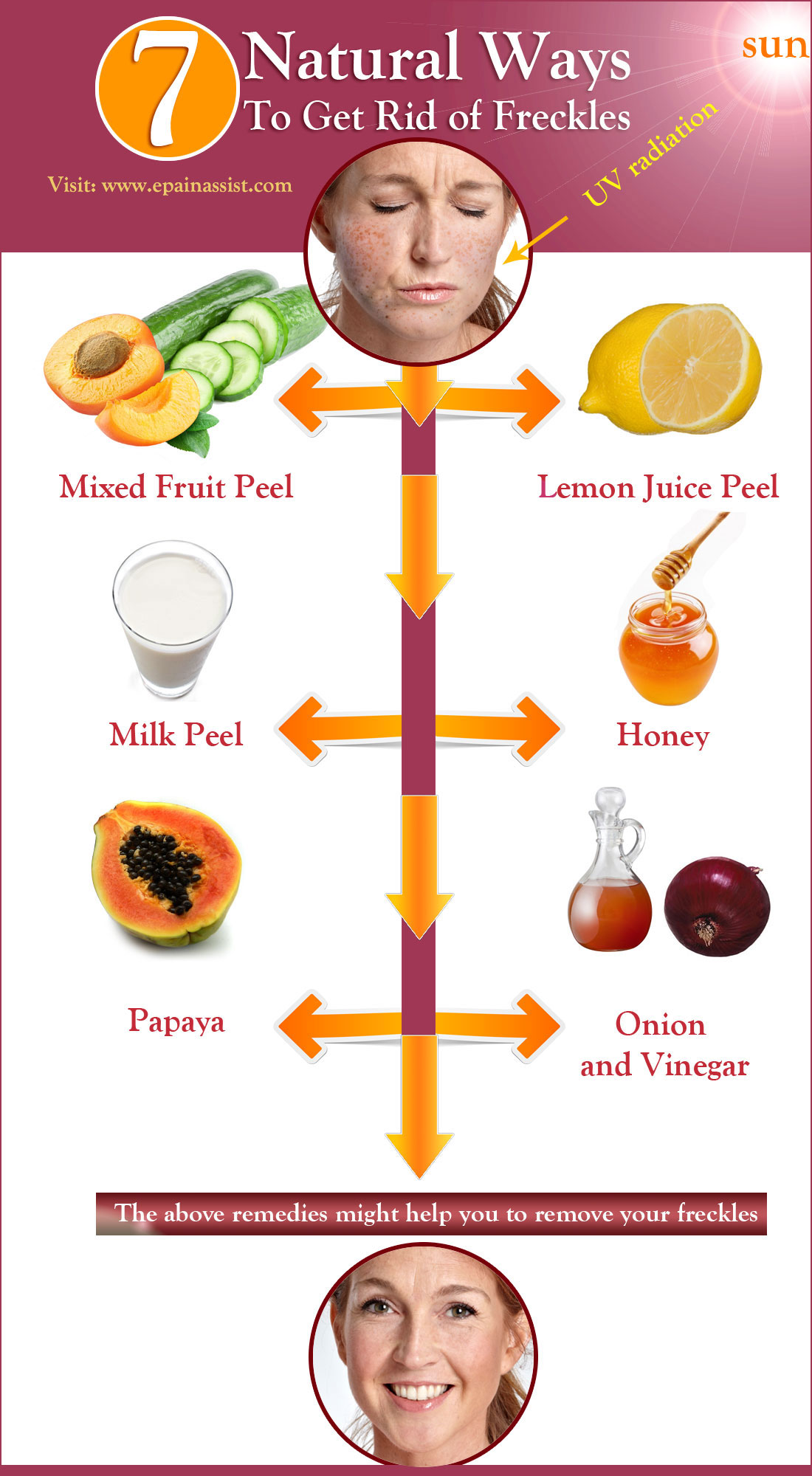 How Can I Remove Freckles