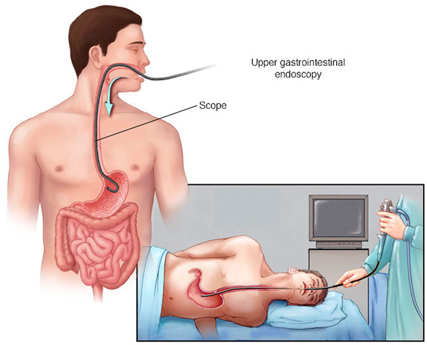 How Long Is An Endoscopy