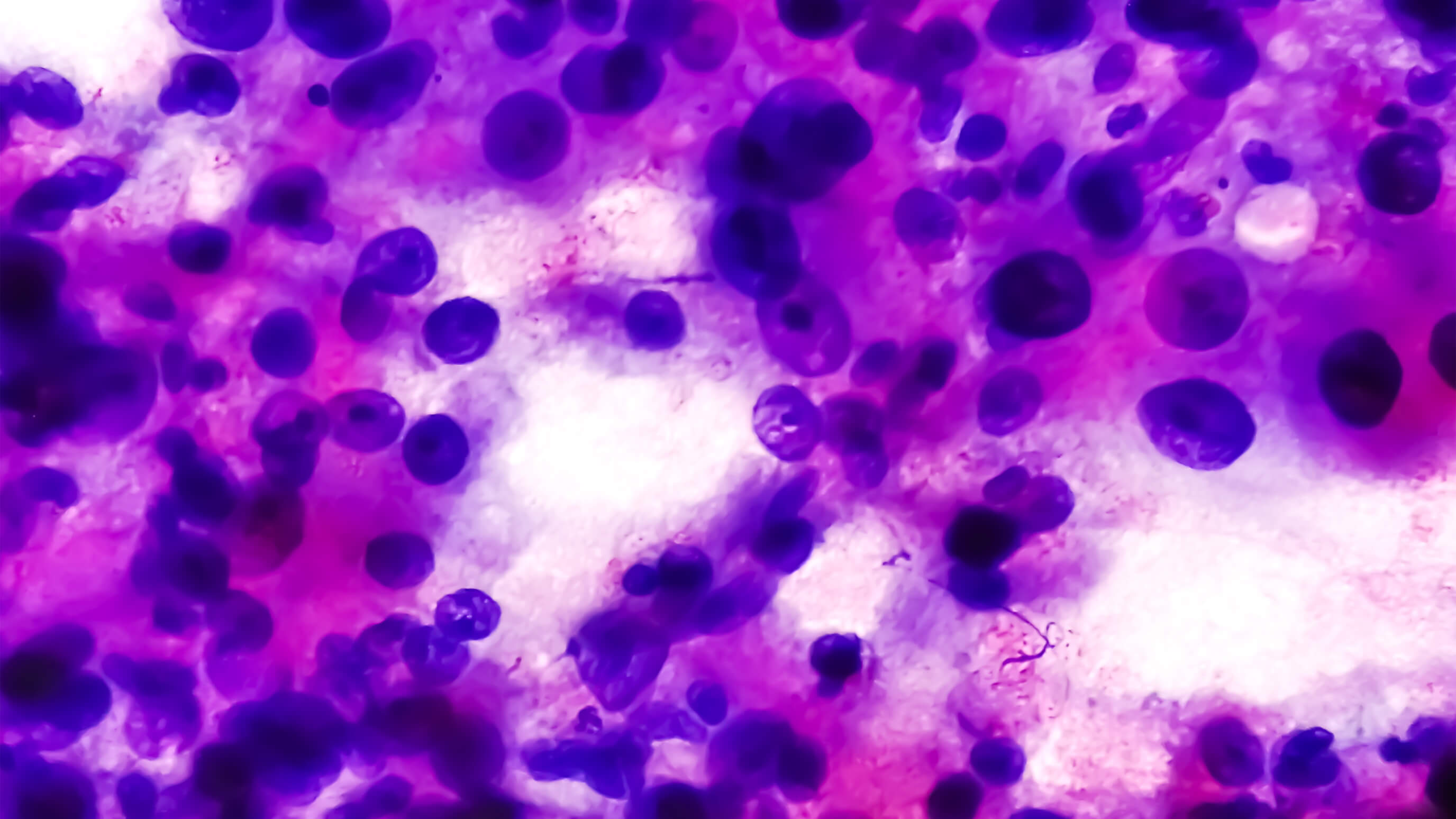How Rare Is Cancer
