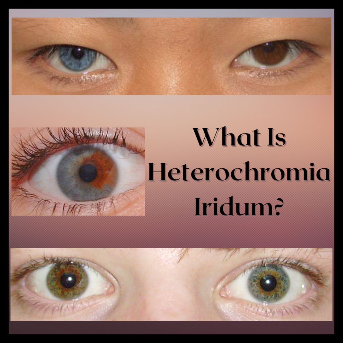 How Rare Is Heterochromia In Humans