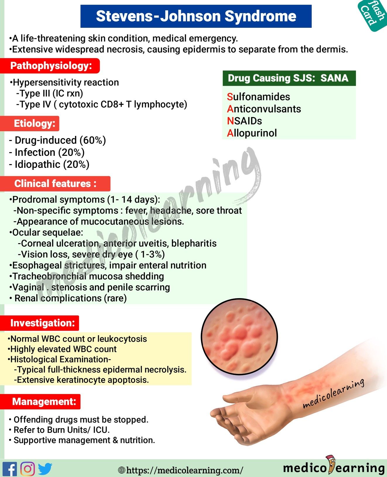 How Rare Is Steven Johnson Syndrome