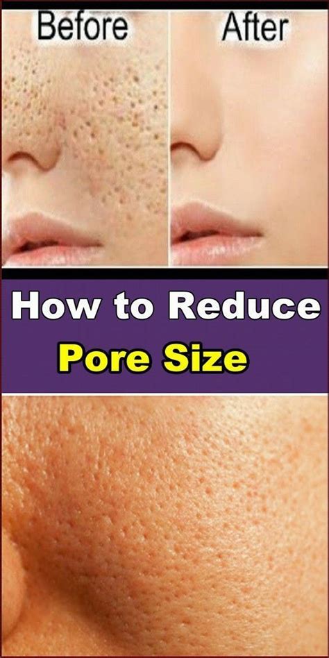 How To Reduce Pore Size