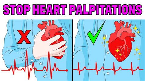 How To Stop Heart Palpitations