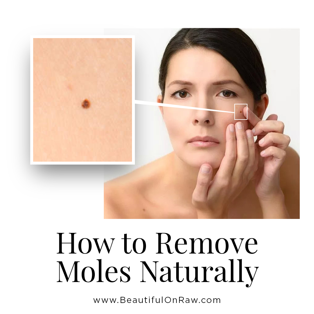 How To Take Moles Off
