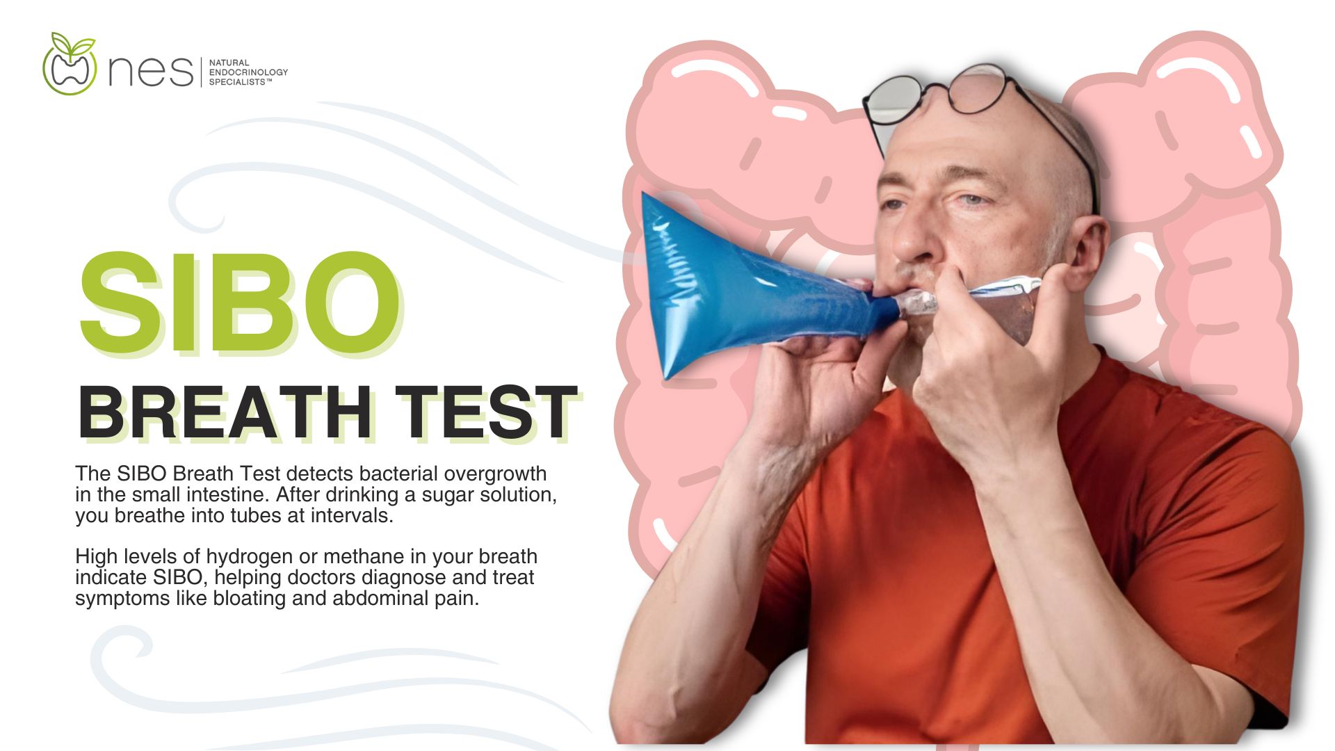 How To Test For Sibo