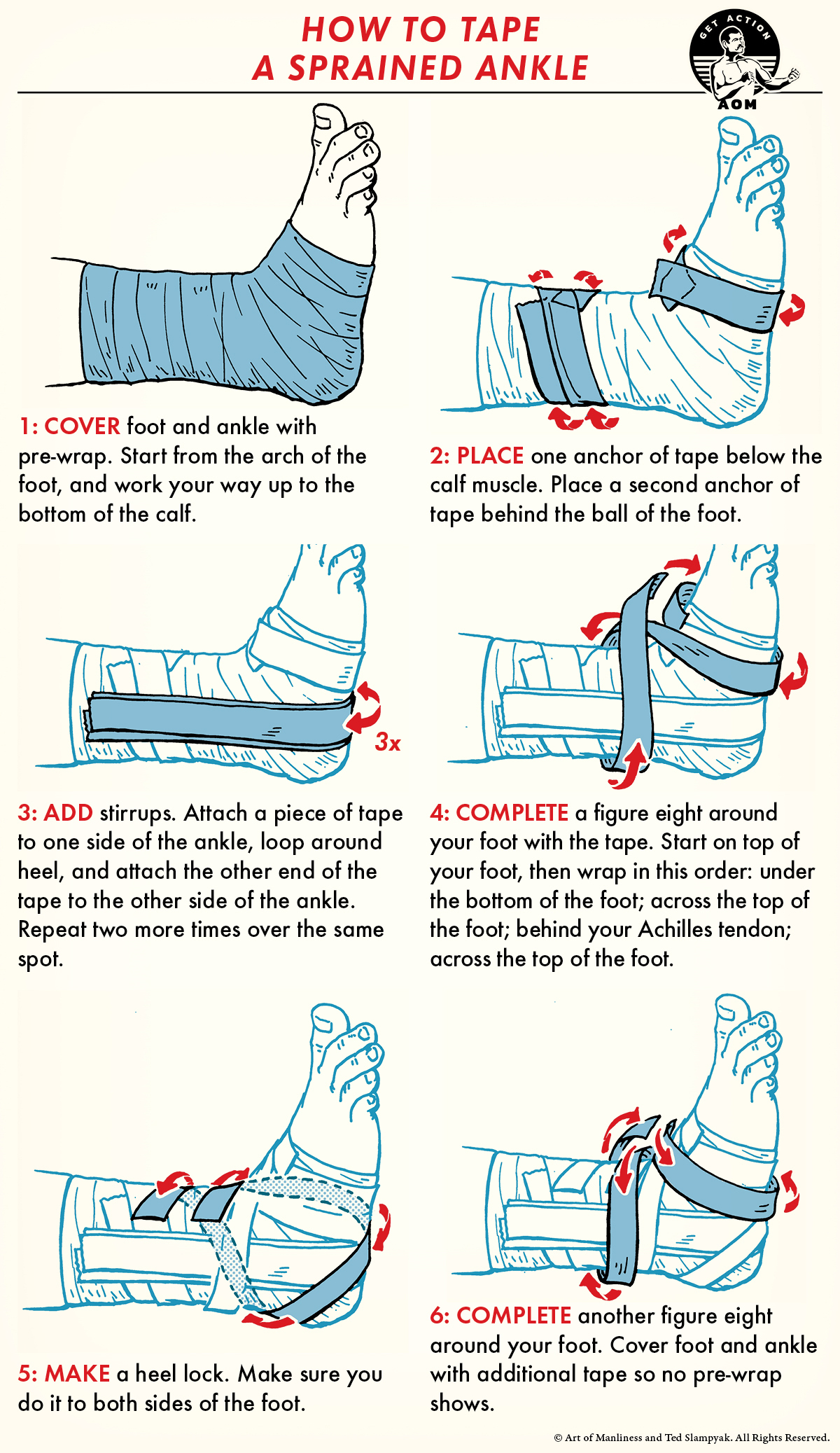 How To Wrap Sprained Ankle