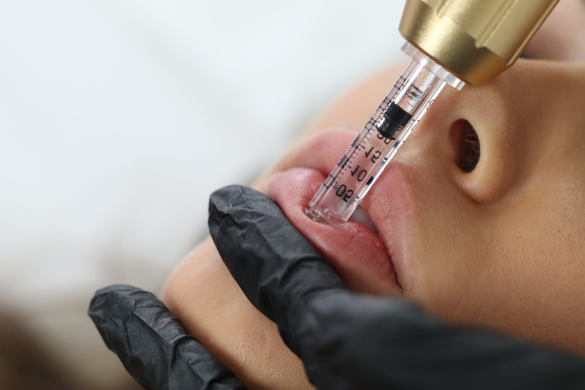 Hyaluron Pen Lip Filler