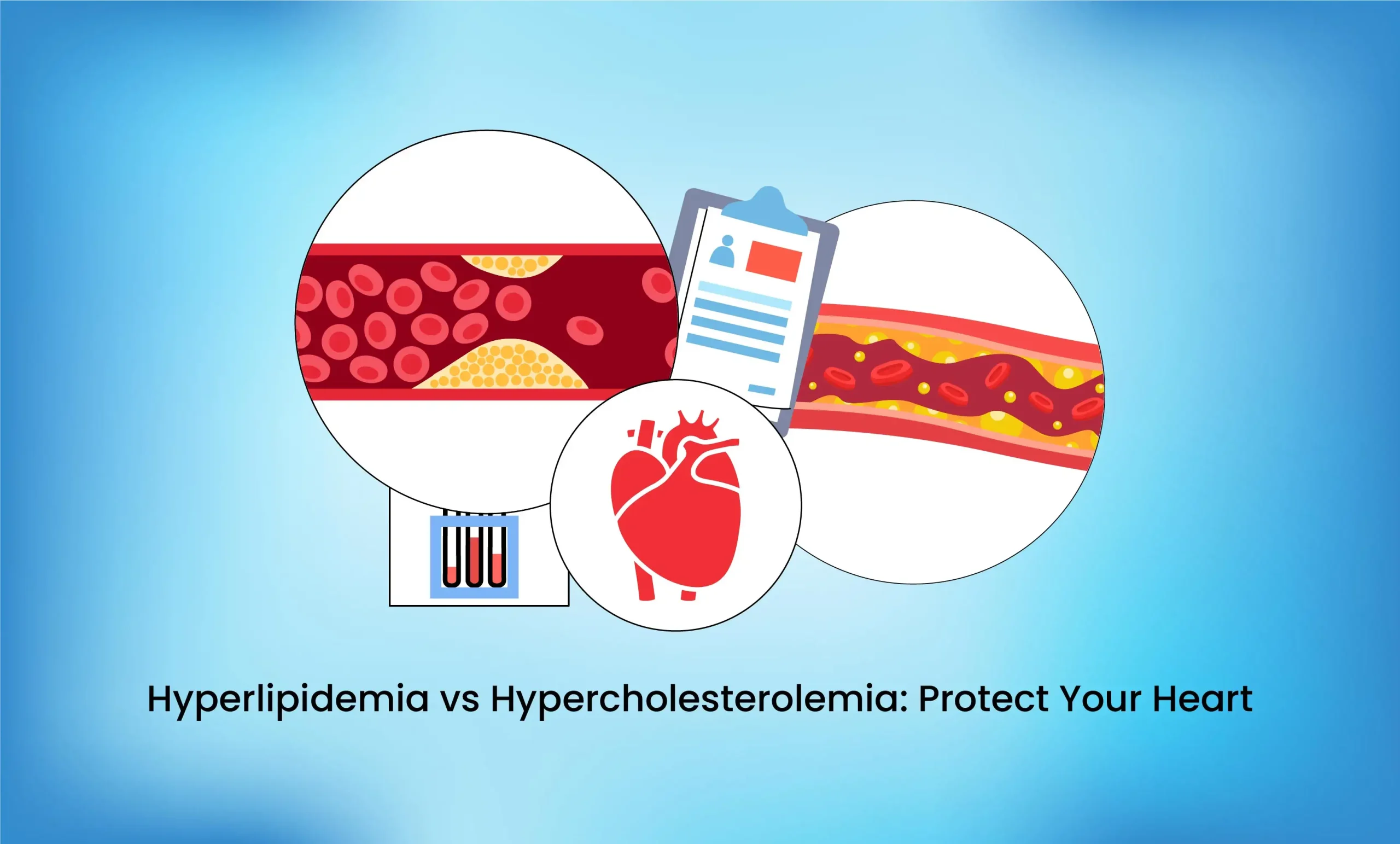 Hyperlipidemia Vs Hypercholesterolemia