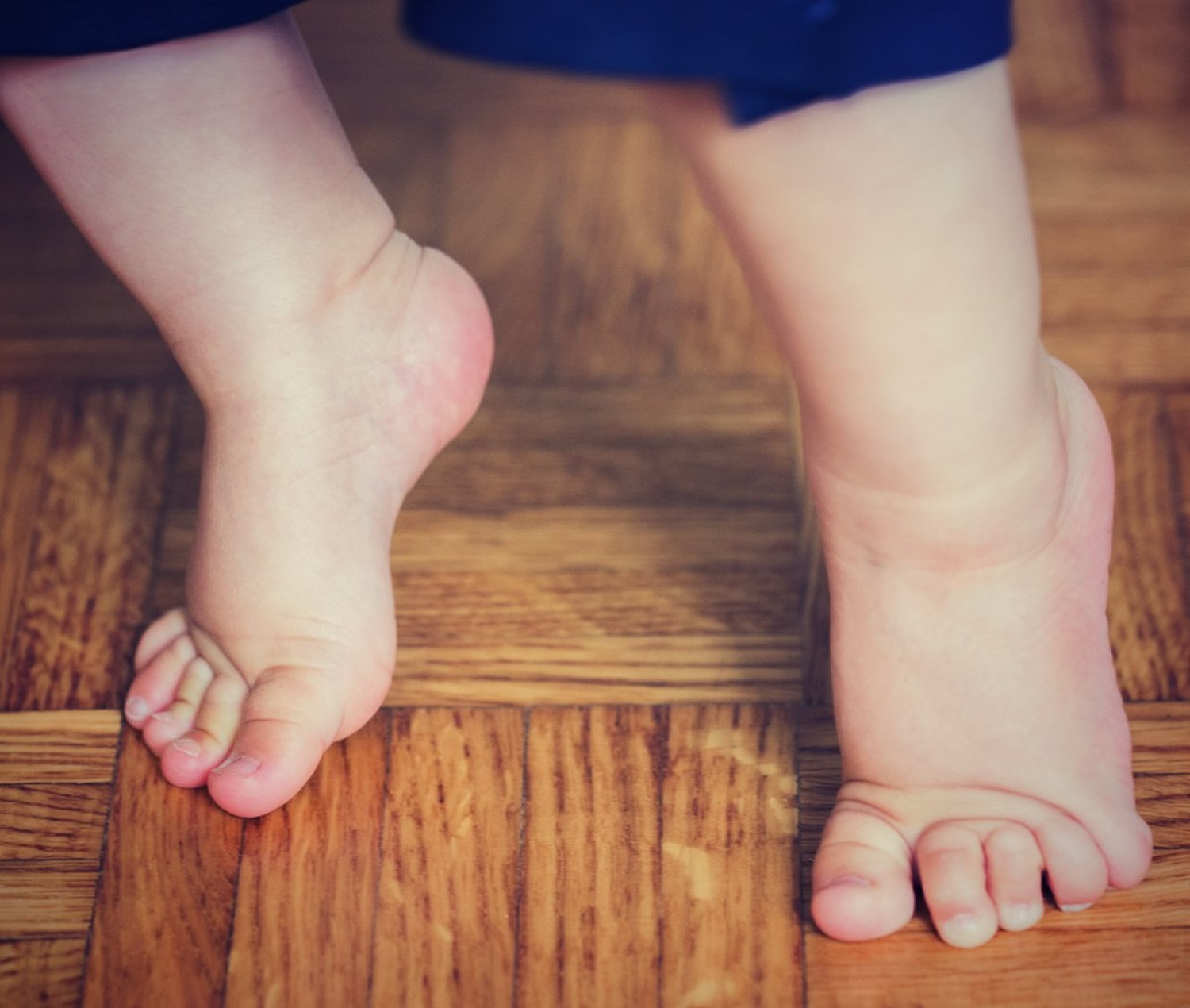 Idiopathic Toe Walking