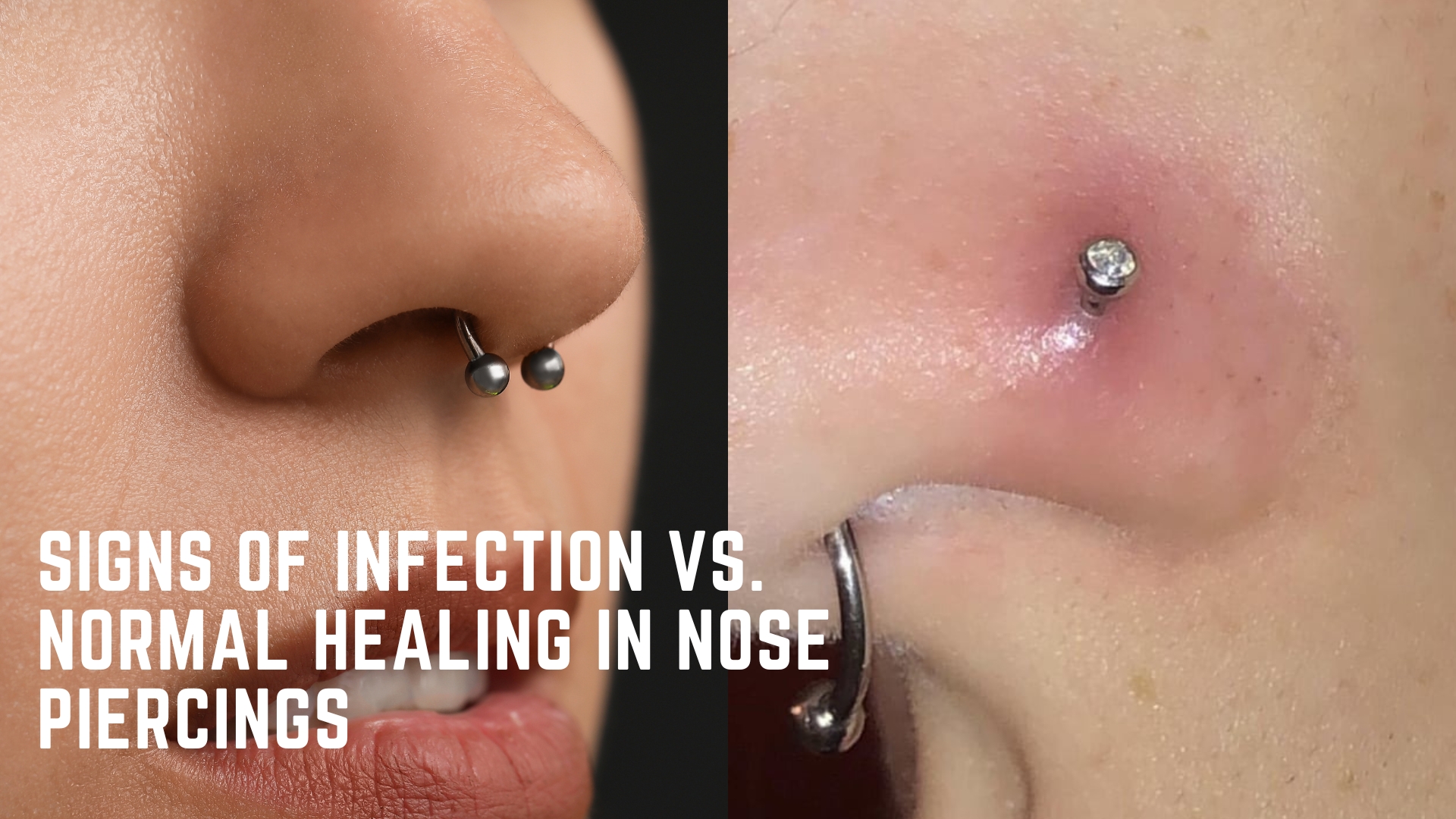 Infected Nostril Piercing