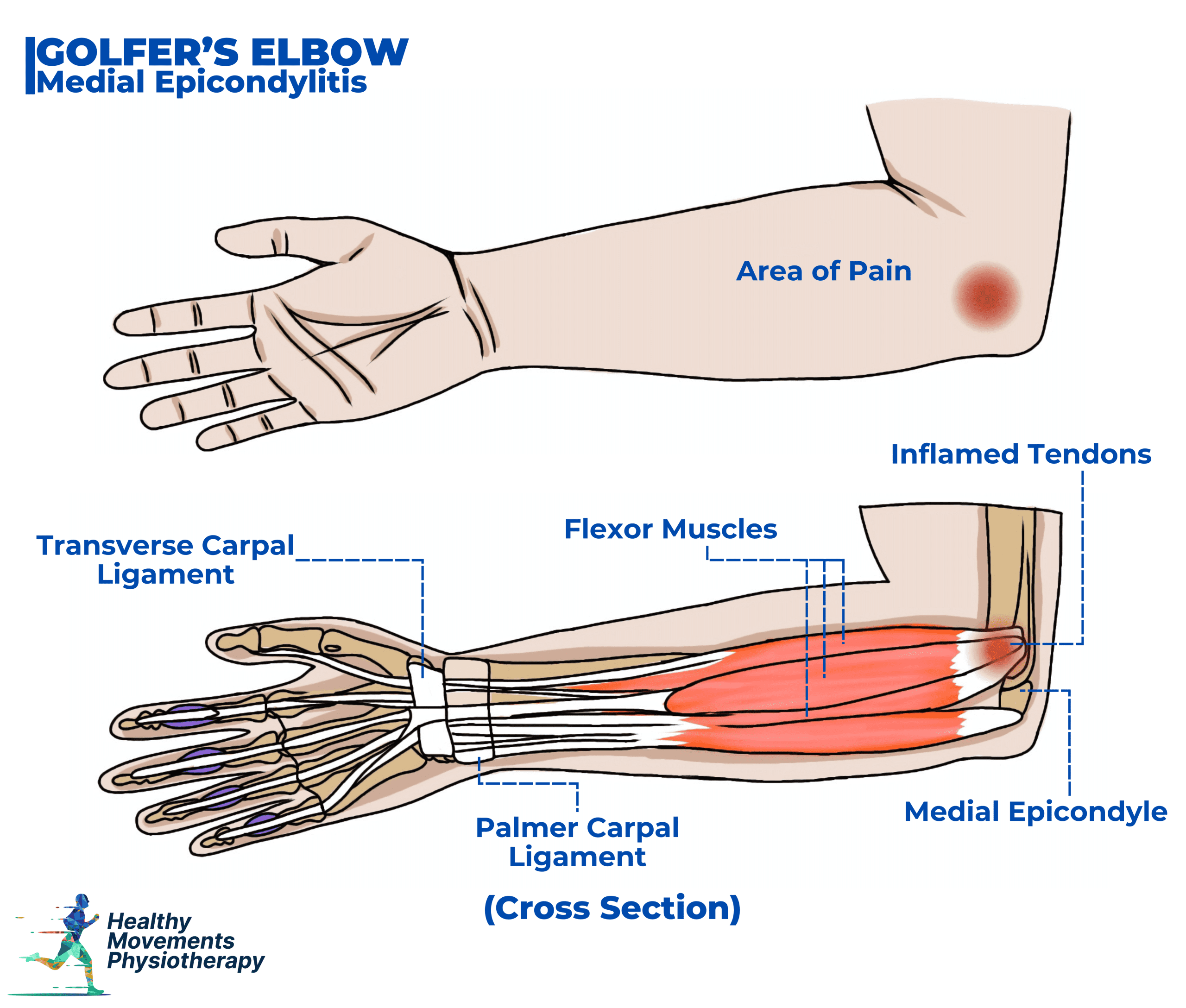 Inside Elbow Pain