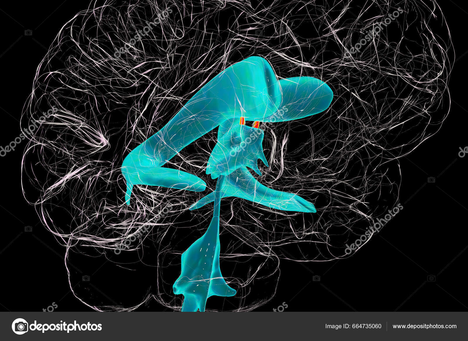Interventricular Foramen Monro
