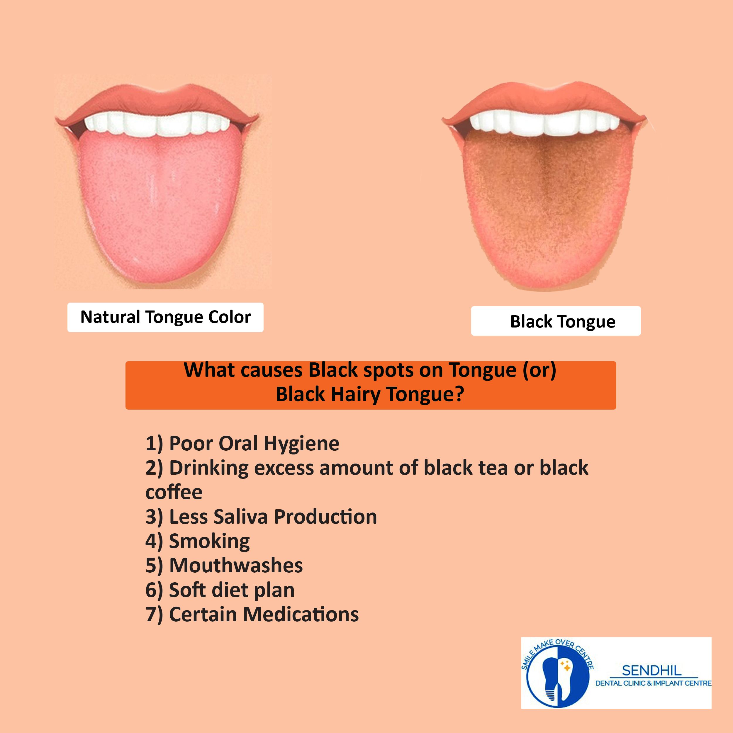 Is Black Tongue Dangerous