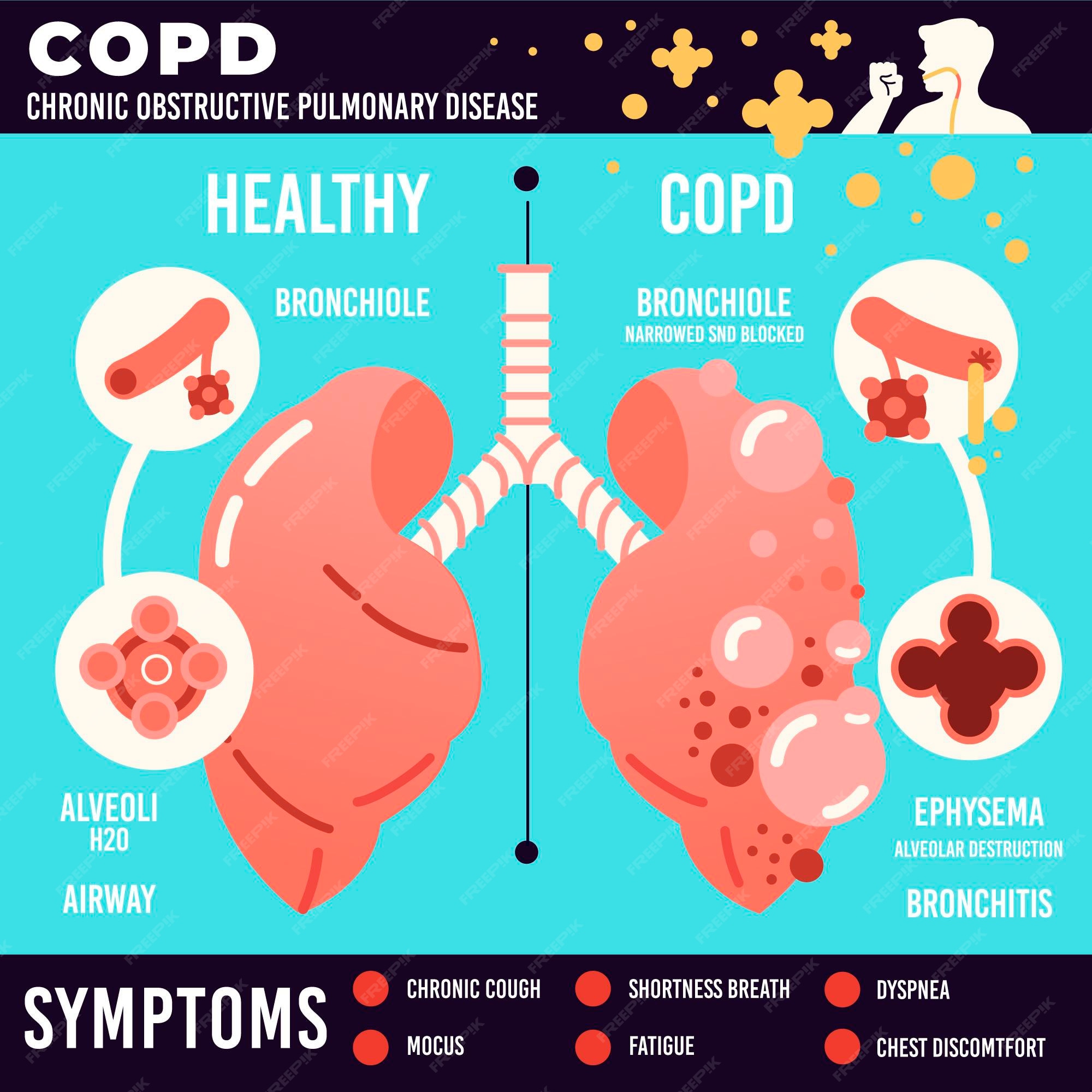 Is Copd Disease Contagious