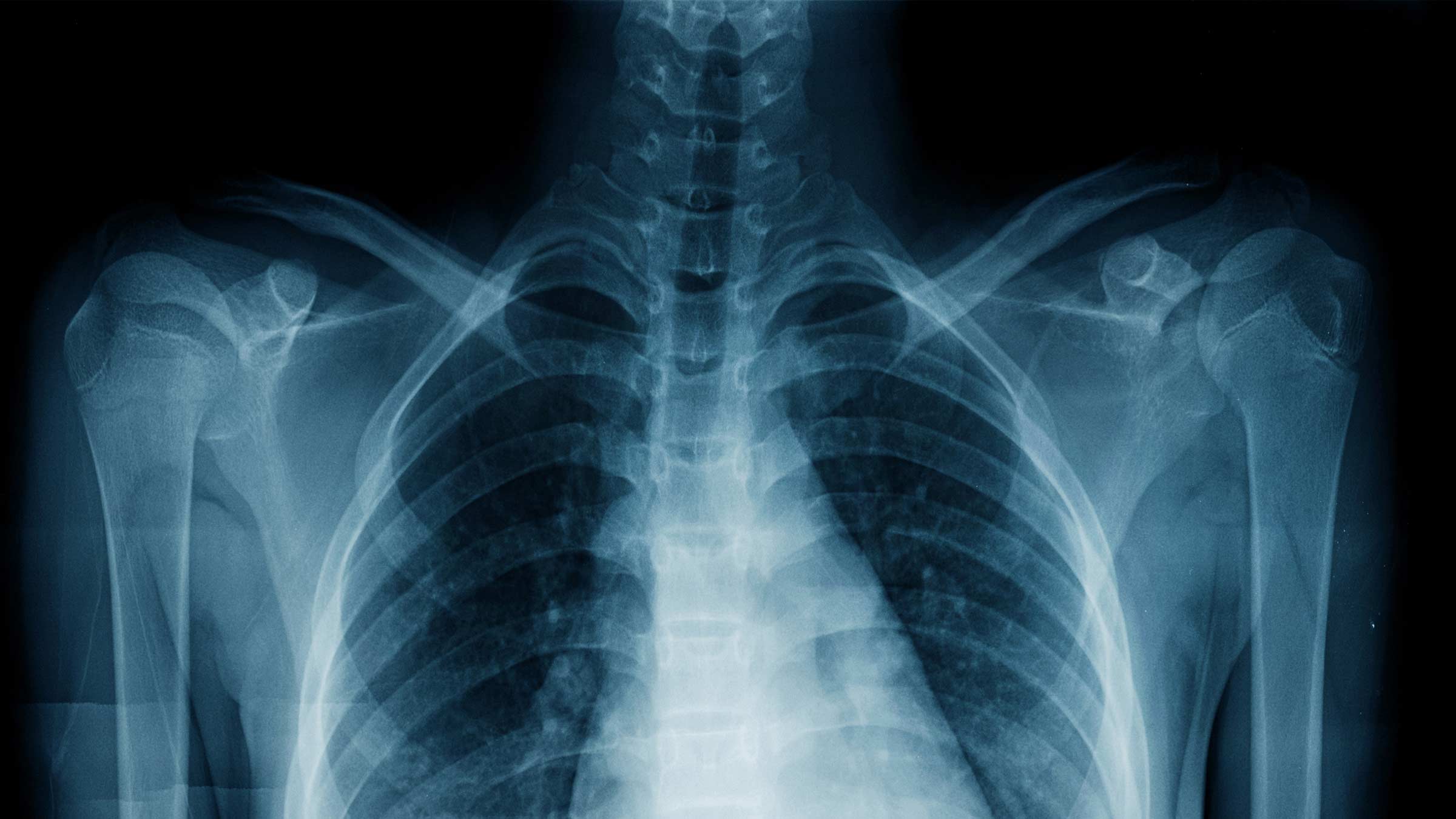 Is It Okay To X Ray Twice