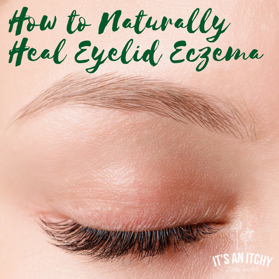 Itchy Eyelids Home Remedy