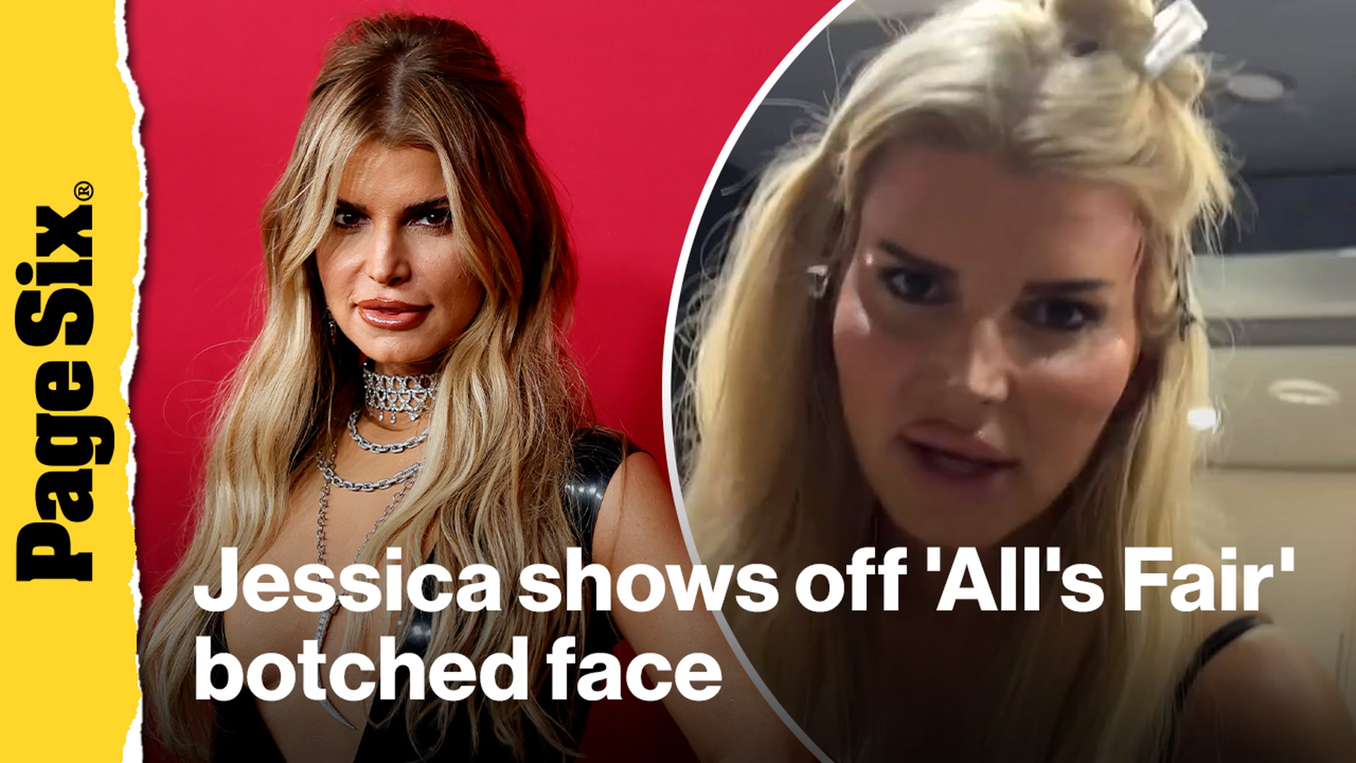 Jessica Simpson Plastic Surgery Face