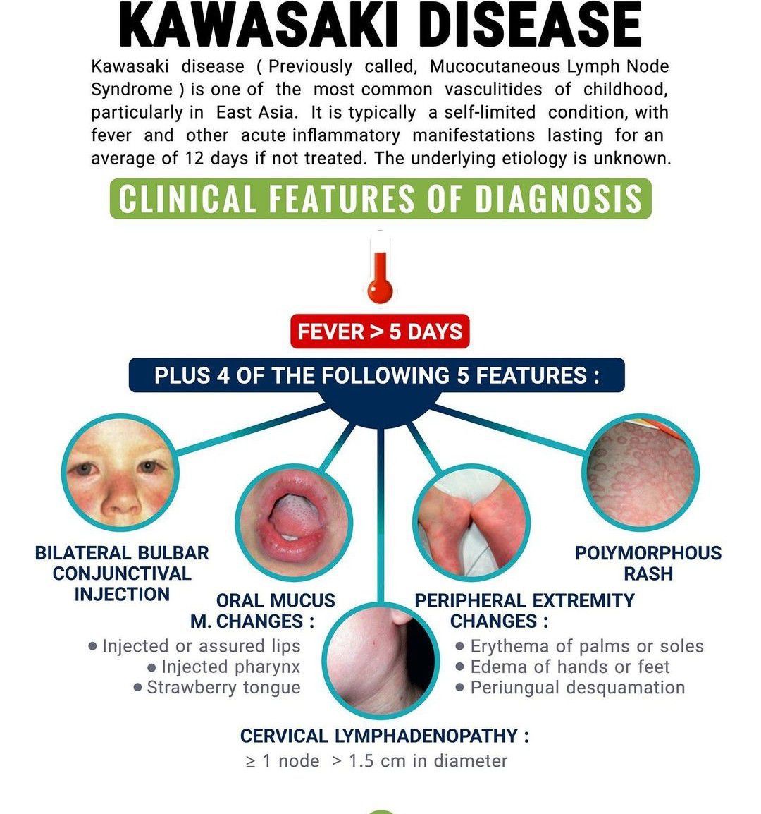 Kawasaki Disease In Adults