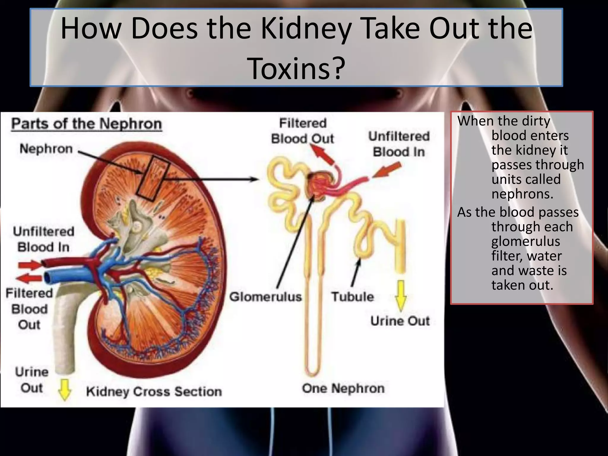 Kidney Taken Out