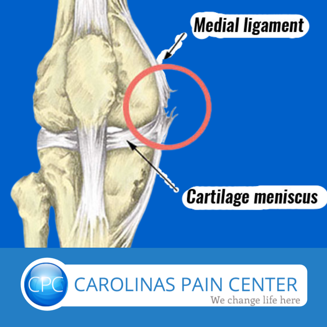 Knee Joint Ligament Tear Treatment