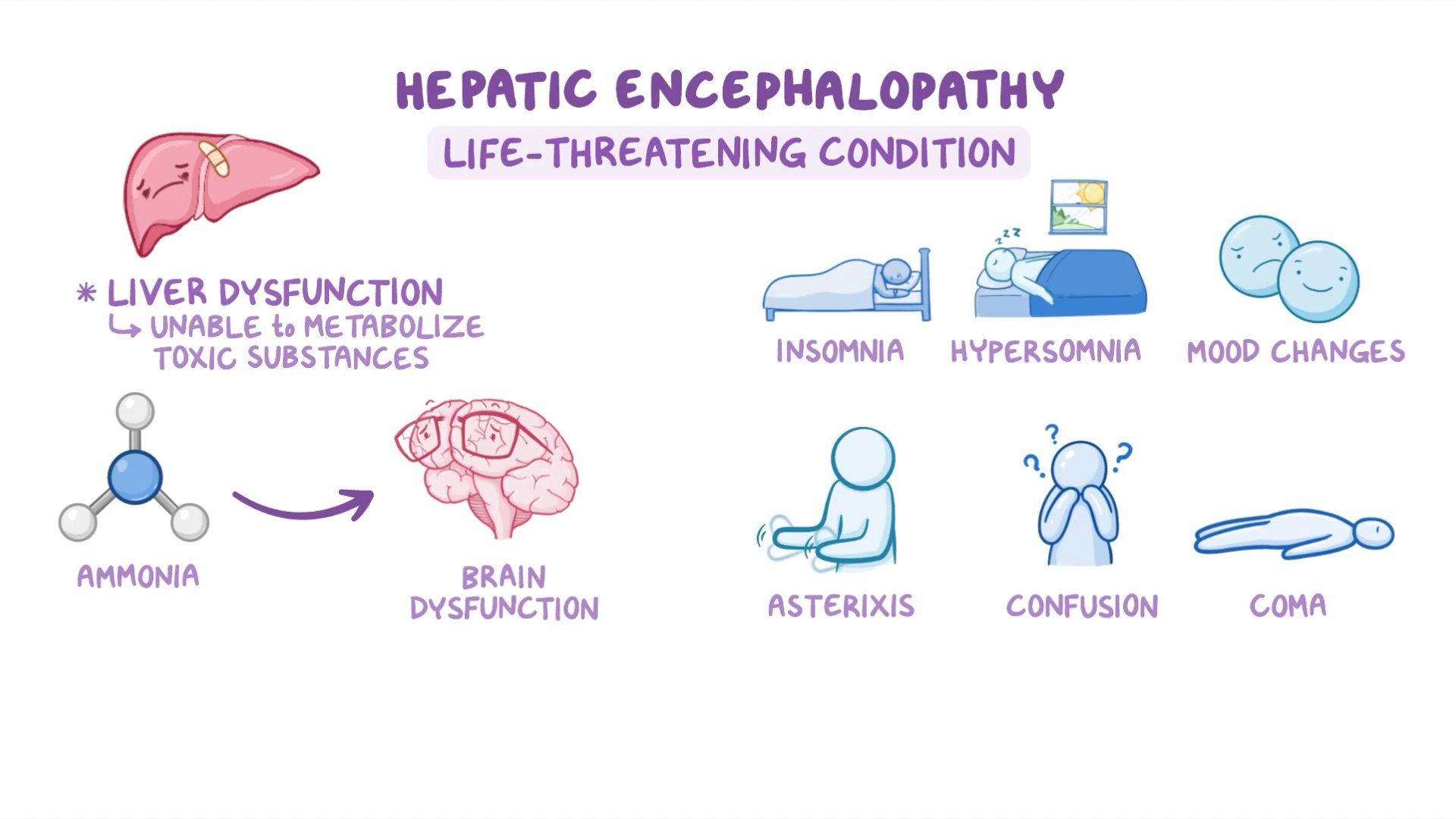Lactulose In Hepatic Coma